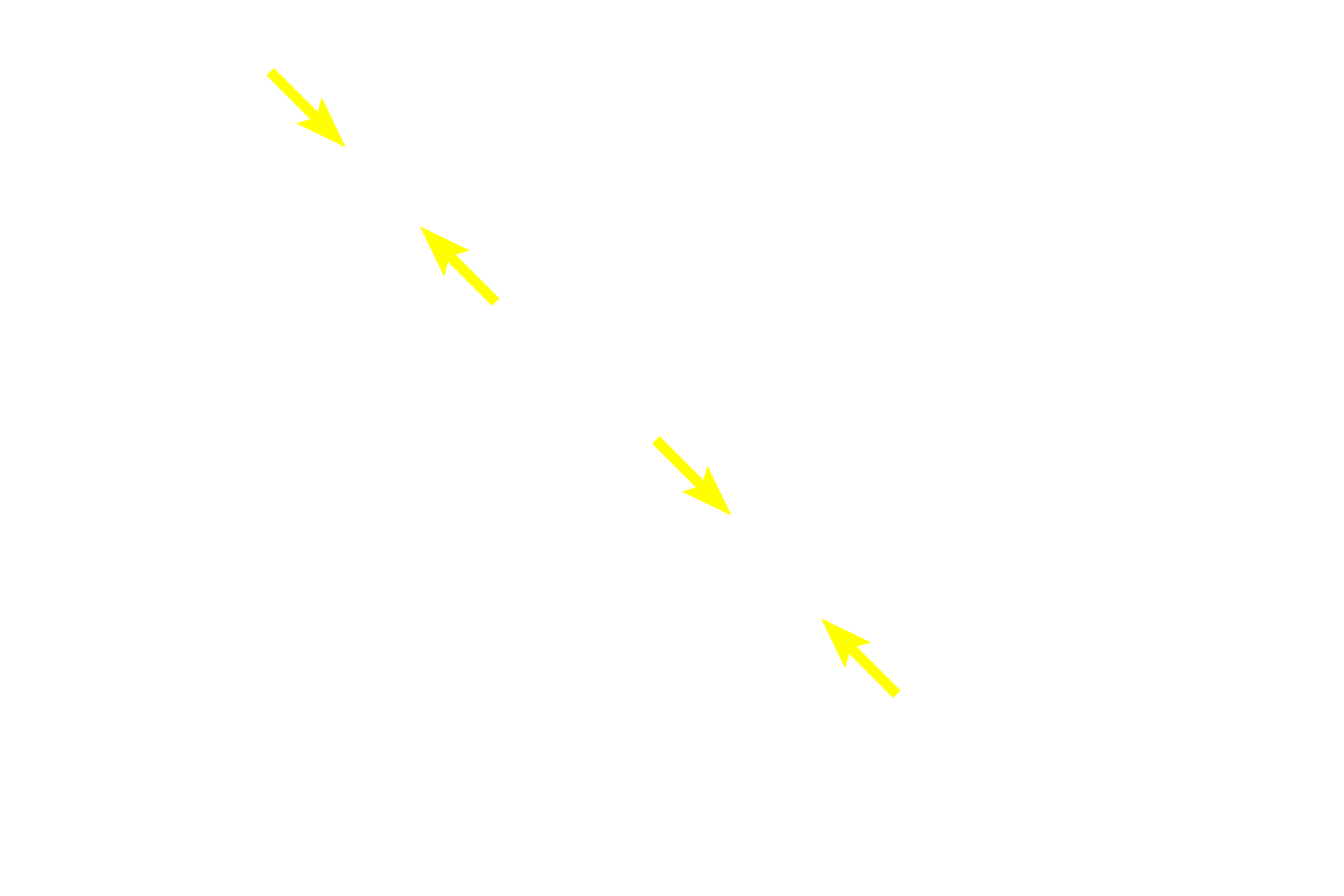 Periarterial lymphoid sheath (PALS) <p>As germinal centers enlarge within in the PALS, they displace the central arteriole to a more eccentric position, as seen here.  Surrounding the lymphoid nodule is red pulp in which the splenic sinuses are completely filled with blood, obscuring the lumens. The junction of the white pulp with red pulp is referred to as the marginal zone, and sinuses located in this region are termed marginal sinuses.  200x</p>
