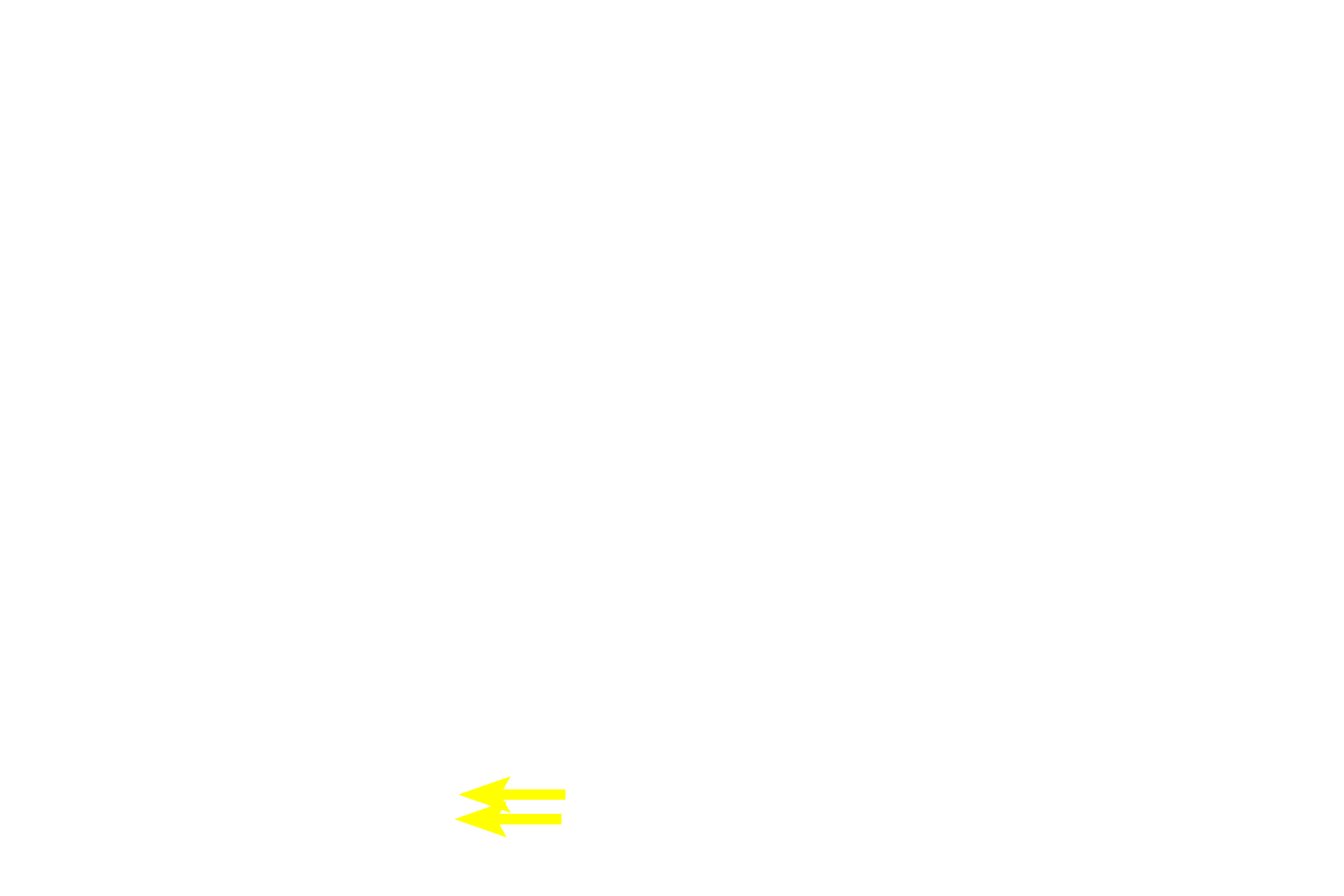 Central arteriole <p>As germinal centers enlarge within in the PALS, they displace the central arteriole to a more eccentric position, as seen here.  Surrounding the lymphoid nodule is red pulp in which the splenic sinuses are completely filled with blood, obscuring the lumens. The junction of the white pulp with red pulp is referred to as the marginal zone, and sinuses located in this region are termed marginal sinuses.  200x</p>
