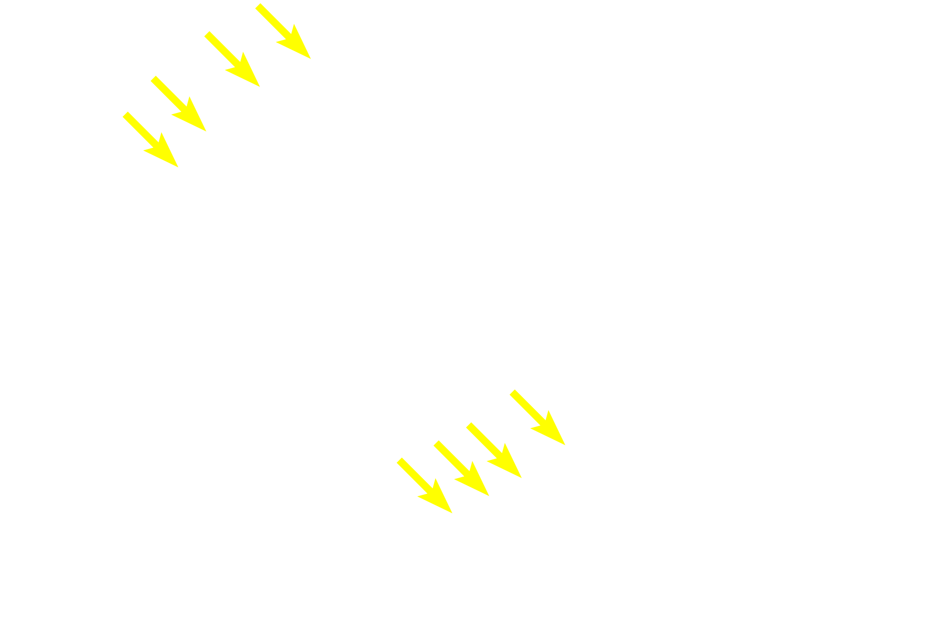 Marginal zone <p>As germinal centers enlarge within in the PALS, they displace the central arteriole to a more eccentric position, as seen here.  Surrounding the lymphoid nodule is red pulp in which the splenic sinuses are completely filled with blood, obscuring the lumens. The junction of the white pulp with red pulp is referred to as the marginal zone, and sinuses located in this region are termed marginal sinuses.  200x</p>
