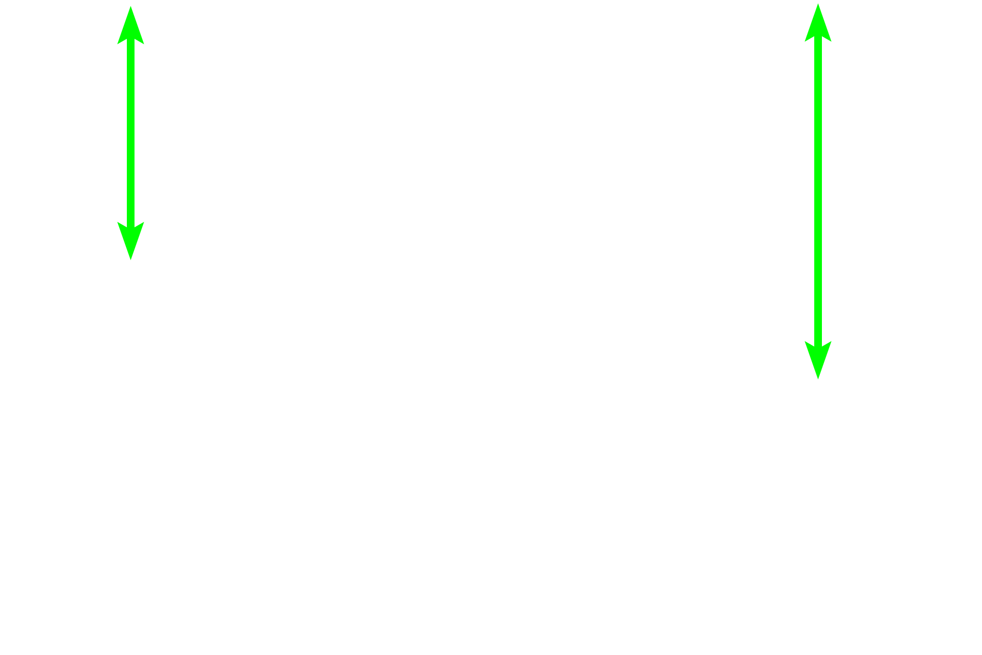 Red Pulp <p>The marginal zone is a region located at the interface of the PALS with the red pulp. The marginal zone contains numerous thin walled blood sinuses, which are supplied by radial branches from the central arteriole. The surrounding reticular tissue contains numerous lymphocytes and macrophages.   The marginal zone is an important transit area for both immune cells and antigens and for the initiation of an immune response.  400x</p>
