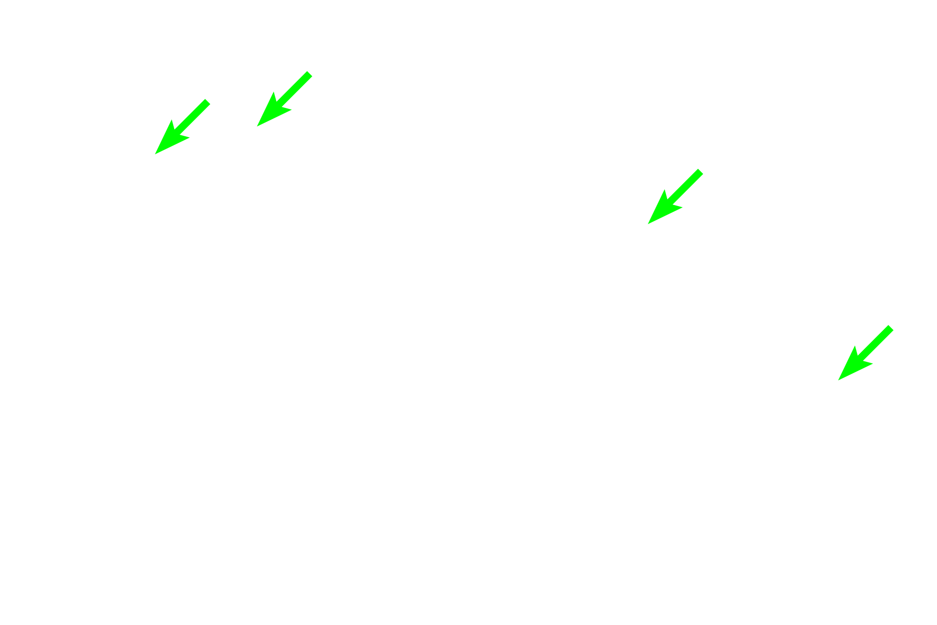 Marginal sinuses <p>The marginal zone is a region located at the interface of the PALS with the red pulp. The marginal zone contains numerous thin walled blood sinuses, which are supplied by radial branches from the central arteriole. The surrounding reticular tissue contains numerous lymphocytes and macrophages.   The marginal zone is an important transit area for both immune cells and antigens and for the initiation of an immune response.  400x</p>
