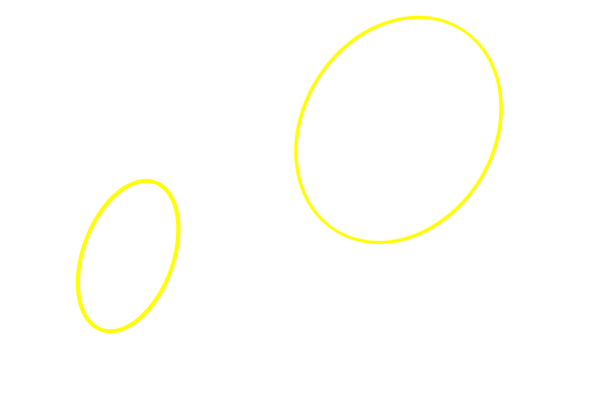 White pulp <p>This image demonstrates areas of white pulp surrounded by red pulp.  Red pulp is composed of splenic cords (cords of Billroth) separated by splenic sinuses.  After passing through vessels in the white pulp, blood continues into the splenic sinuses in the red pulp.  Splenic sinuses eventually anastomose to form splenic veins which travel in the trabeculae to exit the spleen.  100x</p>
