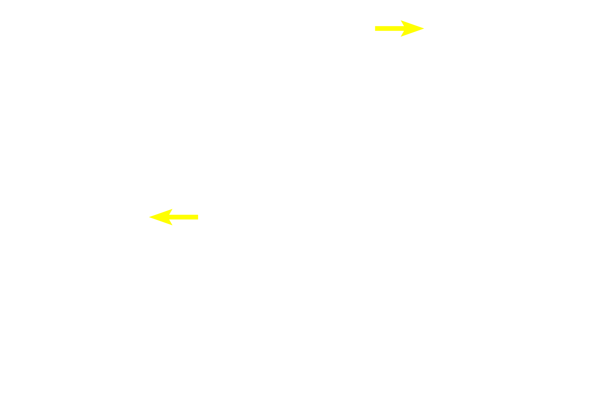 Central arterioles <p>This image demonstrates areas of white pulp surrounded by red pulp.  Red pulp is composed of splenic cords (cords of Billroth) separated by splenic sinuses.  After passing through vessels in the white pulp, blood continues into the splenic sinuses in the red pulp.  Splenic sinuses eventually anastomose to form splenic veins which travel in the trabeculae to exit the spleen.  100x</p>
