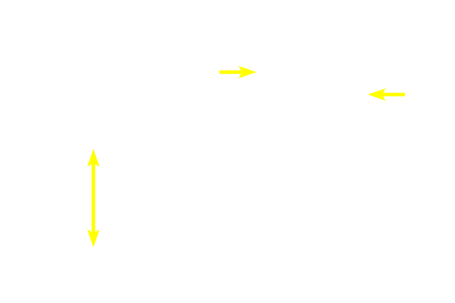 Periarterial lymphoid sheath (PALS) <p>This image demonstrates areas of white pulp surrounded by red pulp.  Red pulp is composed of splenic cords (cords of Billroth) separated by splenic sinuses.  After passing through vessels in the white pulp, blood continues into the splenic sinuses in the red pulp.  Splenic sinuses eventually anastomose to form splenic veins which travel in the trabeculae to exit the spleen.  100x</p>
