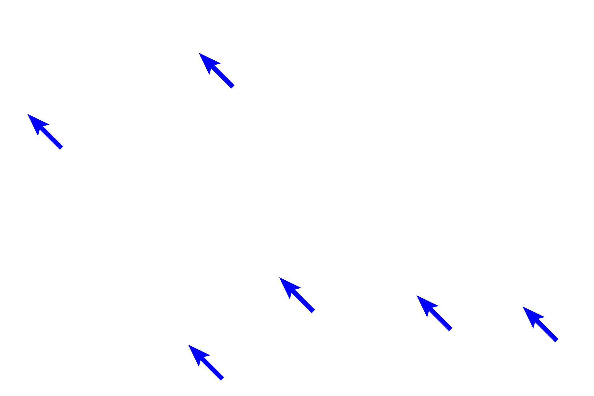 Splenic cords <p>This image demonstrates areas of white pulp surrounded by red pulp.  Red pulp is composed of splenic cords (cords of Billroth) separated by splenic sinuses.  After passing through vessels in the white pulp, blood continues into the splenic sinuses in the red pulp.  Splenic sinuses eventually anastomose to form splenic veins which travel in the trabeculae to exit the spleen.  100x</p>
