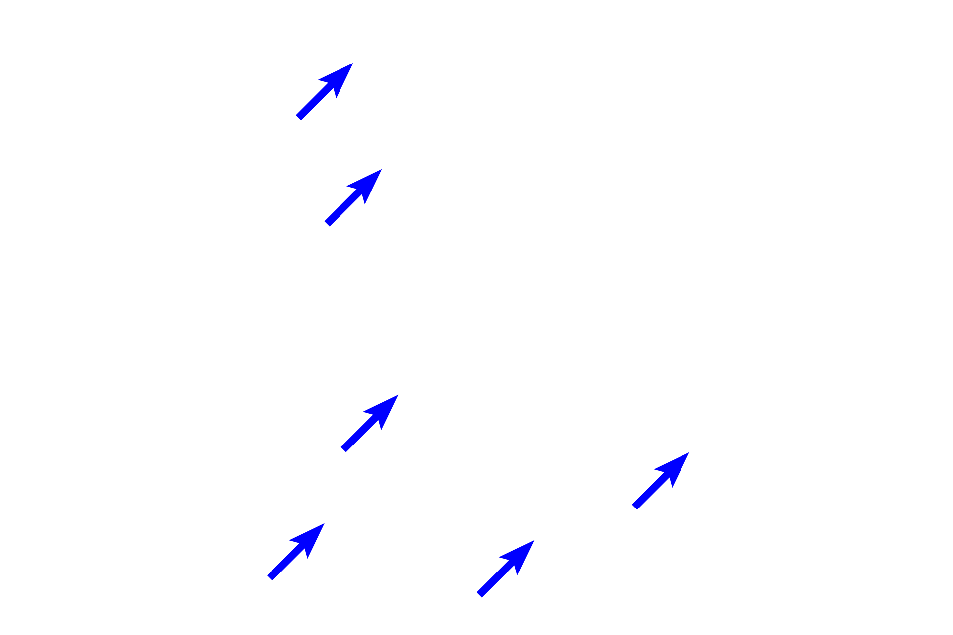 Splenic sinuses <p>This image demonstrates areas of white pulp surrounded by red pulp.  Red pulp is composed of splenic cords (cords of Billroth) separated by splenic sinuses.  After passing through vessels in the white pulp, blood continues into the splenic sinuses in the red pulp.  Splenic sinuses eventually anastomose to form splenic veins which travel in the trabeculae to exit the spleen.  100x</p>
