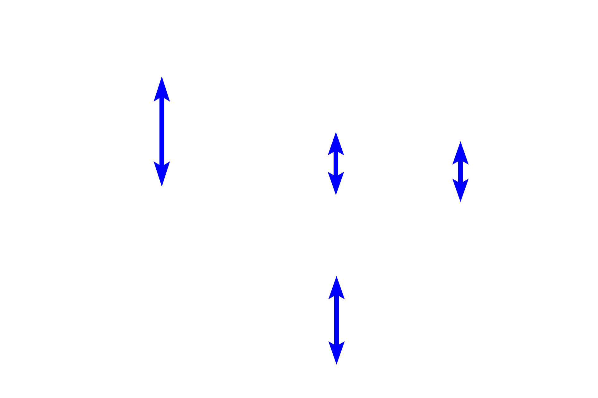 Splenic sinuses > <p>Splenic sinuses are unique sinusoidal vessels lined by highly elongated endothelial cells with large nuclei that bulge into the sinus lumen. The cells are oriented longitudinally with spaces between them, much like slats in a barrel.  These spaces facilitate movement of blood cells in and out of the sinus. Processes of macrophages span the lumen, providing surveillance for antigens in the blood.</p>
