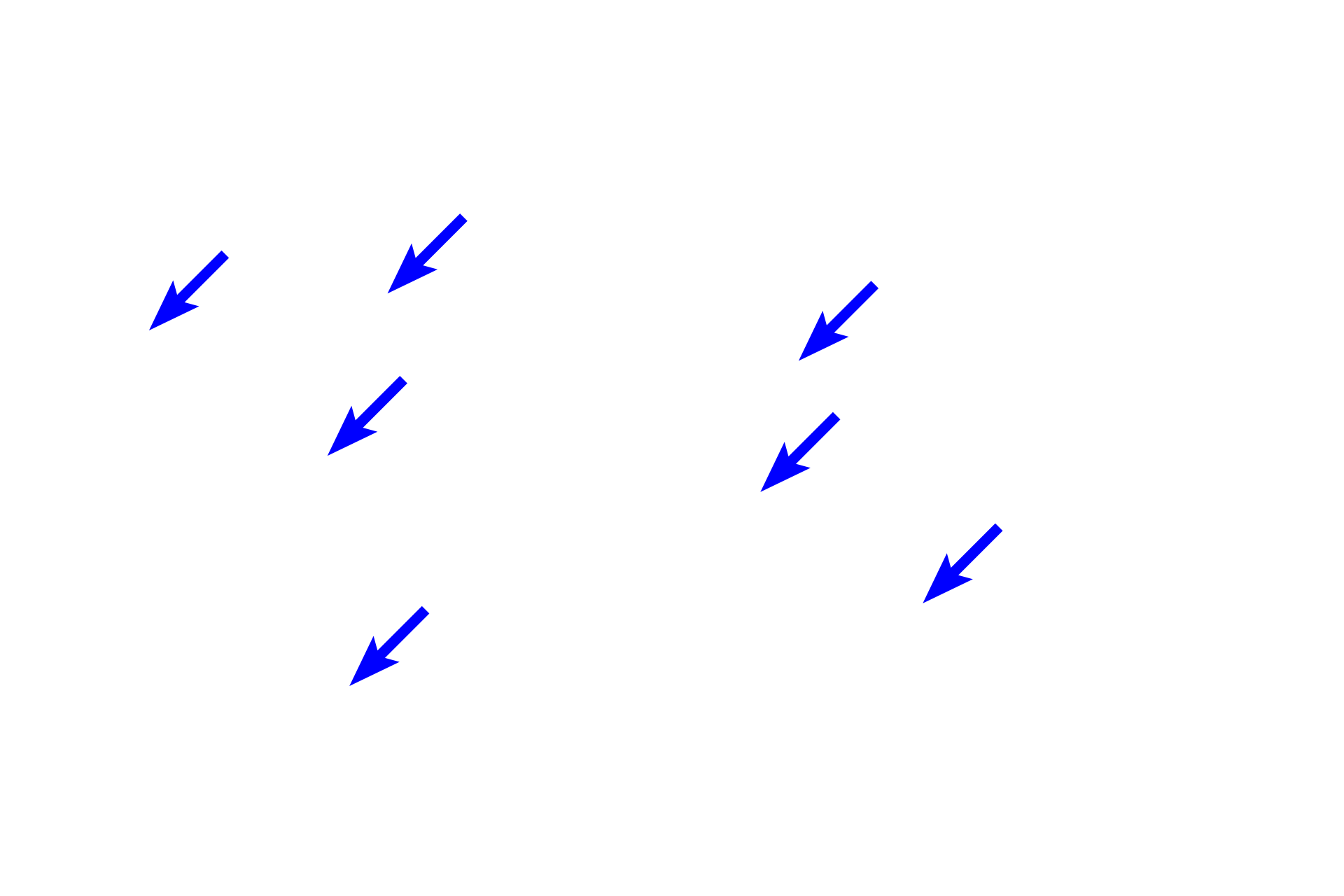 Red blood cells <p>Splenic cords consist of a loose meshwork of reticular cells and fibers that support large numbers of erythrocytes, lymphocytes, macrophages, plasma cells, and granulocytes. Damaged red blood cells are phagocytosed and destroyed by splenic macrophages and the iron from hemoglobin is reclaimed for new red blood cell formation.</p>
