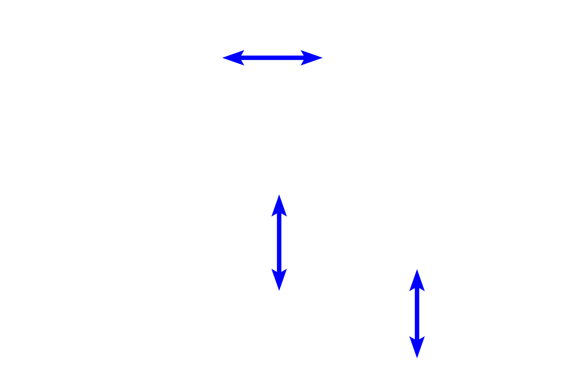 Splenic sinuses > <p>Sinuses (discontinuous capillaries or sinusoids) are capillaries that have wide lumens, fenestrations, gaps or discontinuities between adjacent endothelial cells, and a basal lamina that is interrupted or may be absent. A variety of cell types are present, including macrophages, whose processes span the lumen, surveying antigens in the blood and phagocytosing red blood cells. </p>
