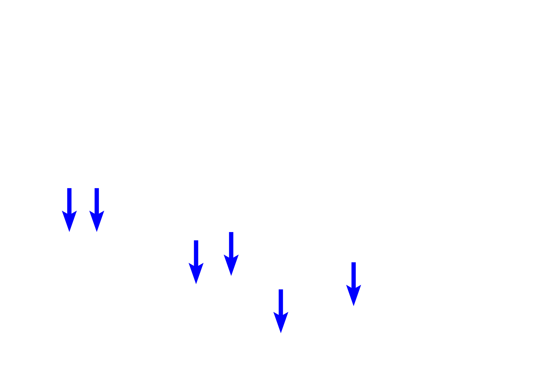 Endothelial cells > <p>The splenic sinuses are venous sinuses and, hence, are lined by endothelial cells.  However, these cells are unique, having large nuclei that bulge into the lumen of the sinusoid. Additionally, these cells are extremely long, with their longitudinal axes oriented parallel to the flow of blood in the sinus.</p>
