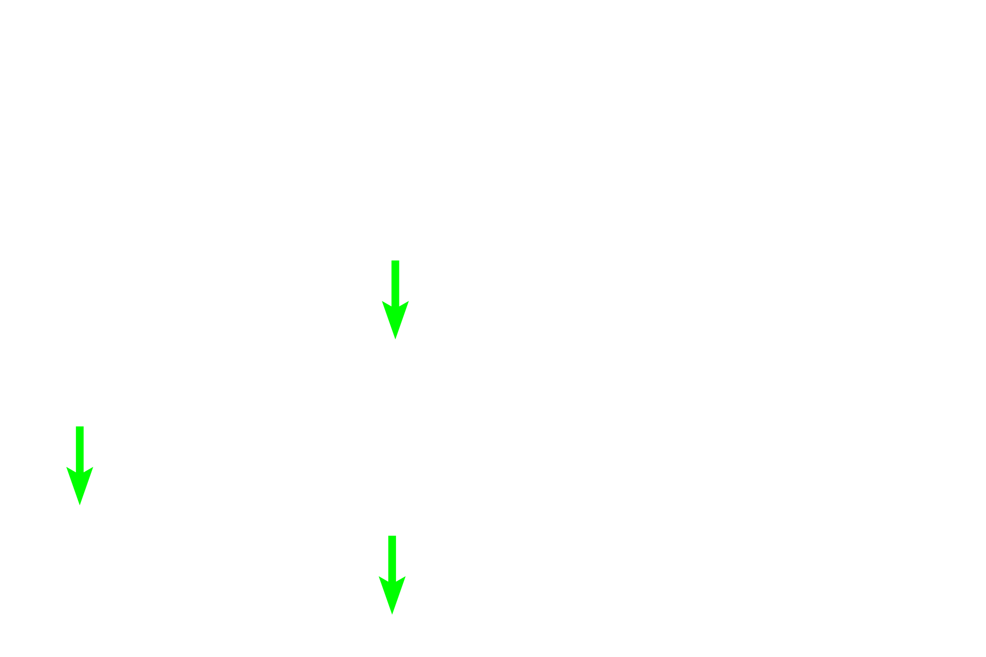 Red blood cells in capillaries <p>Blood carried by sheathed capillaries “bleeds” directly into the stroma of the cord.  Thus, blood cells are not contained within vessels, and red blood cells can be phagocytosed by macrophages.  Blood carried by unsheathed capillaries passes into the sinus, where it is also surveyed by macrophages that span the lumen.</p>
