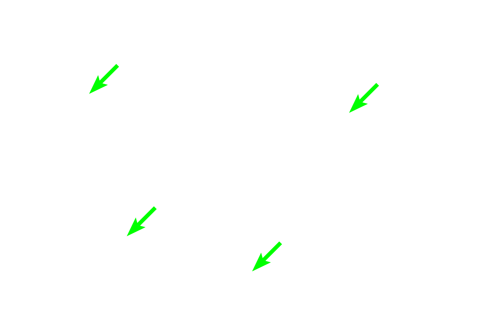 Macrophages with hemosiderin > <p>The major function of the red pulp is the removal of aged and damaged red blood cells by macrophages, which are present both in the cords and sinuses. Red blood cells have a life span of about 120 days in circulation. The iron associated with the hemoglobin, in the form of hemosiderin, is recycled.</p>
