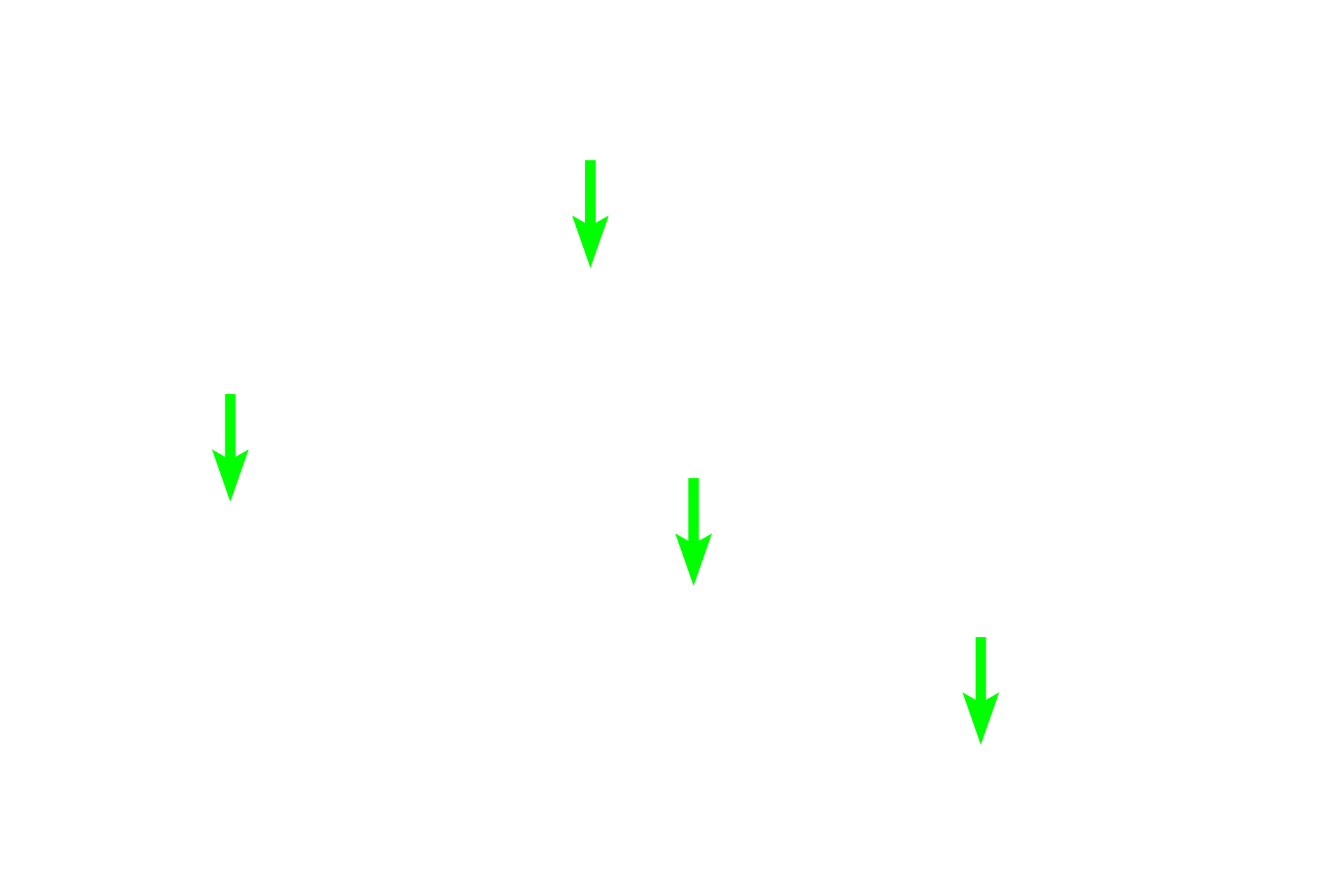 Macrophages in sinus lumen <p>The major function of the red pulp is the removal of aged and damaged red blood cells by macrophages, which are present both in the cords and sinuses. Red blood cells have a life span of about 120 days in circulation. The iron associated with the hemoglobin, in the form of hemosiderin, is recycled.</p>
