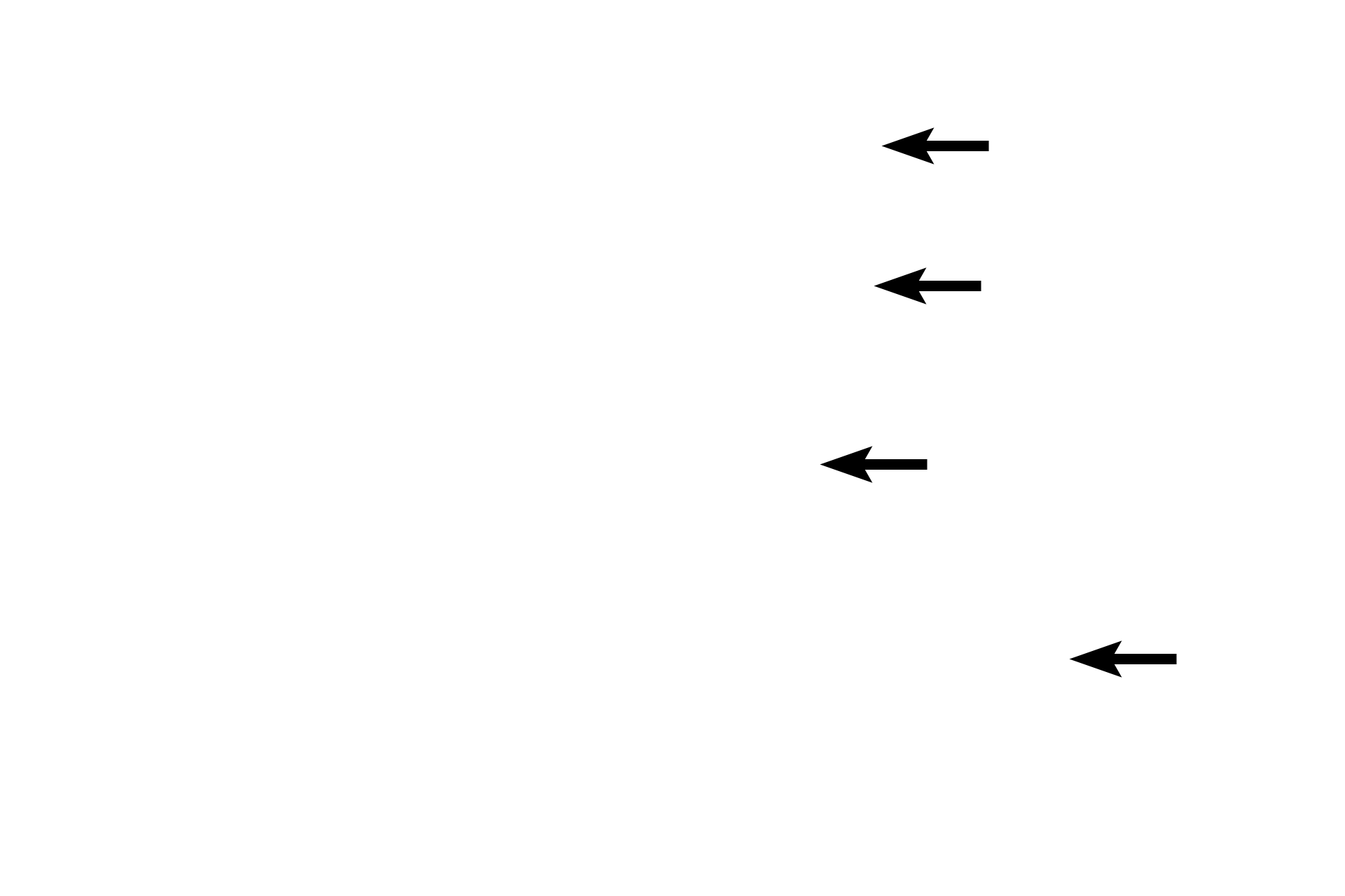 Trabeculae <p>The thymus possesses a thin connective tissue capsule from which trabeculae extend into the parenchyma of the organ. The capsule and trabeculae convey blood vessels into and out of the thymus.  Trabeculae subdivide the organ into thymic lobules, which consist of an outer cortex and a central medulla.  This medullary tissue is continuous between lobules.</p>
