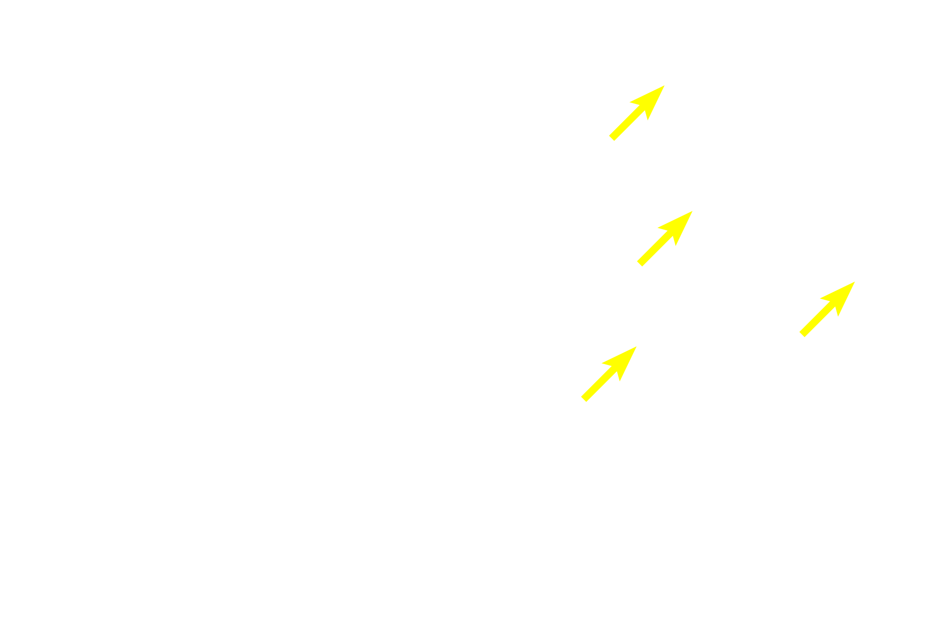 Cortex > <p>The dark-staining, cortex is readily differentiated from the pale-staining medulla. The cortex is composed primarily of densely packed, developing T lymphocytes (thymocytes).  The medulla contains mature and maturing thymocytes and Hassall’s corpuscles, derived from epithelial reticular cells.  Mature T lymphocytes exit the thymus from the medulla. </p>
