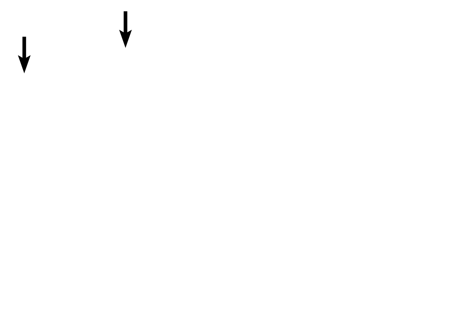 Capsule <p>The dark-staining cortex contains densely packed T-lymphocytes and is easily differentiated from the paler-staining medulla, where the lymphocytes are slightly more dispersed.  The thymic stroma consists of a meshwork of epithelial reticular cells rather than a connective tissue, and hence, no fibers are present.  One diagnostic feature of the thymus, Hassall’s corpuscles, are formed from epithelial reticular cells.  200x</p>
