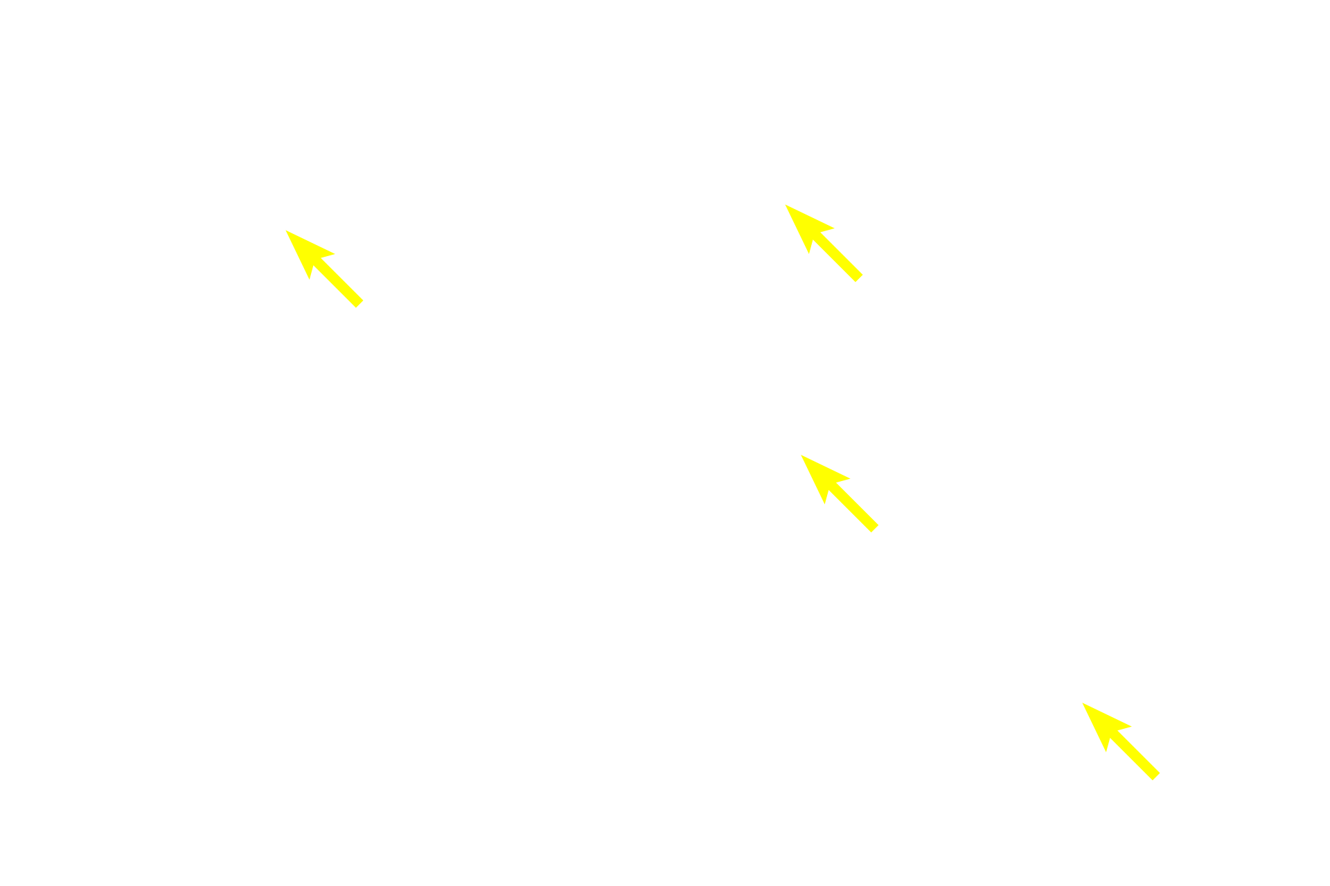 Lymphocytes <p>The dark-staining cortex contains densely packed T-lymphocytes and is easily differentiated from the paler-staining medulla, where the lymphocytes are slightly more dispersed.  The thymic stroma consists of a meshwork of epithelial reticular cells rather than a connective tissue, and hence, no fibers are present.  One diagnostic feature of the thymus, Hassall’s corpuscles, are formed from epithelial reticular cells.  200x</p>
