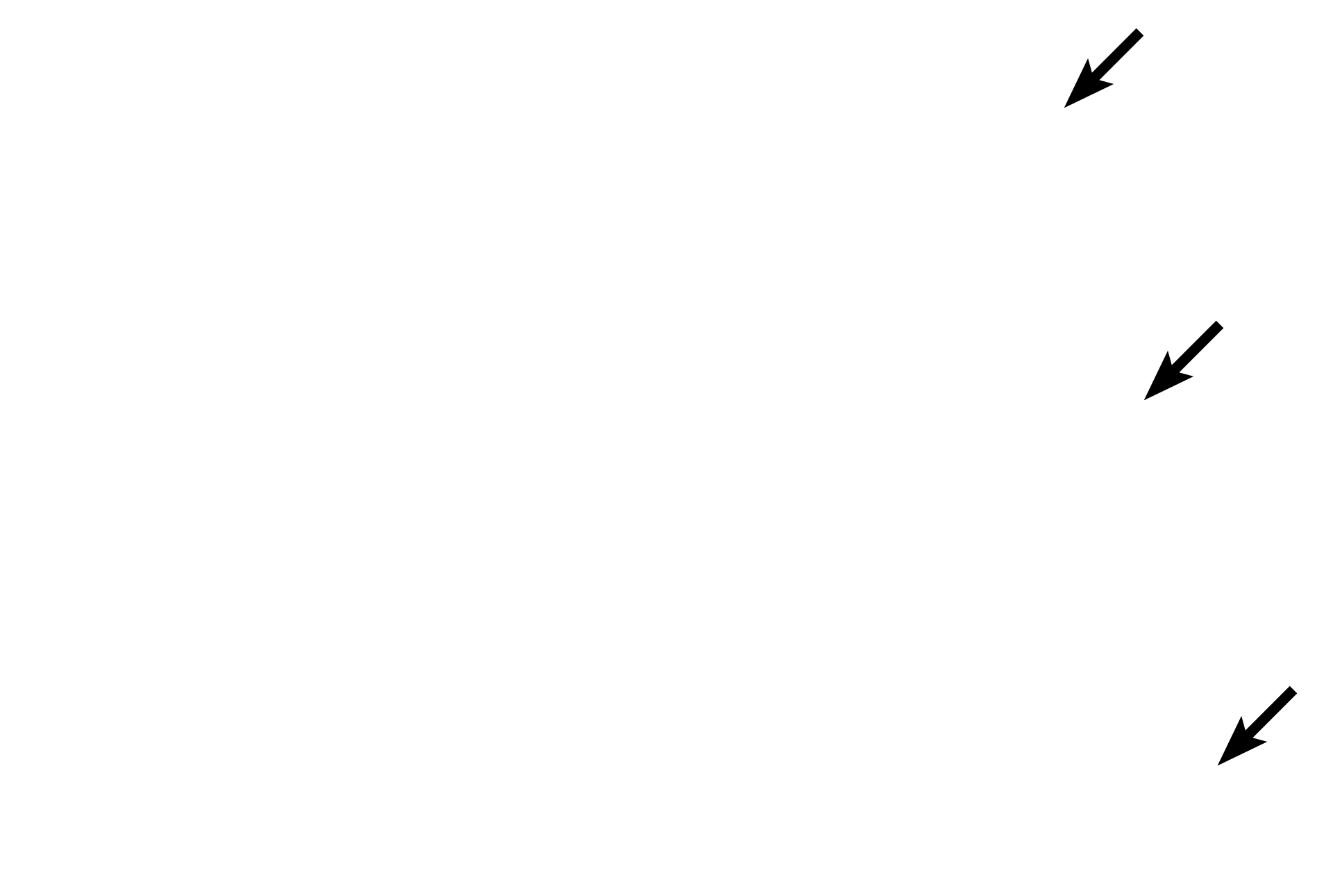 Capsule <p>The cortex with its tightly packed thymocytes is easily differentiated from the paler staining medulla.  One diagnostic feature of the thymus, Hassall’s corpuscles, are located in the medulla.  These structures, formed by one class of epithelial reticular cells, consist of concentrically arranged flattened cells that contain keratohyalin granules, reflecting the epithelial origin of these cells.  200x</p>

