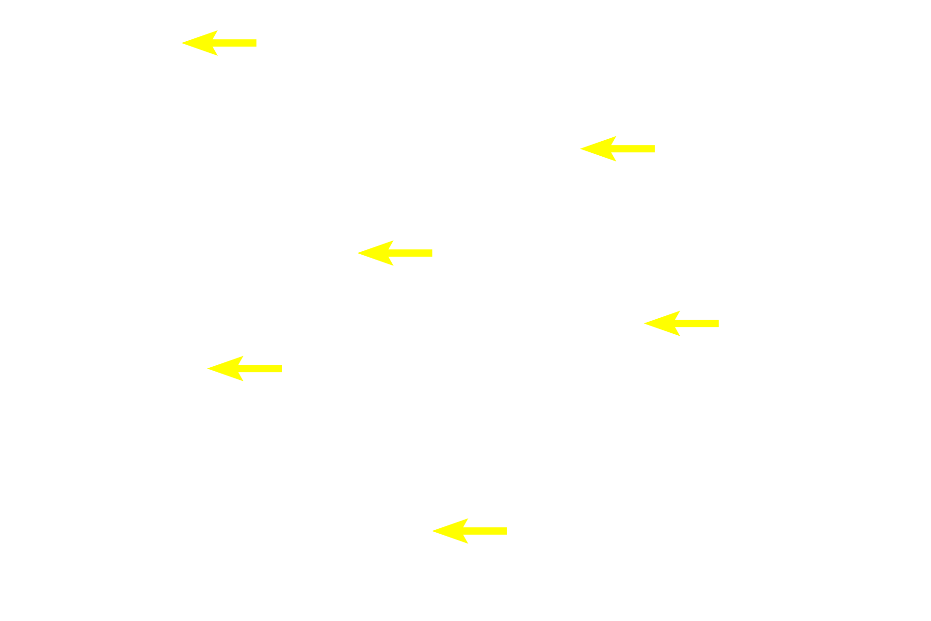 Epithelial reticular cells <p>The cortex with its tightly packed thymocytes is easily differentiated from the paler staining medulla.  One diagnostic feature of the thymus, Hassall’s corpuscles, are located in the medulla.  These structures, formed by one class of epithelial reticular cells, consist of concentrically arranged flattened cells that contain keratohyalin granules, reflecting the epithelial origin of these cells.  200x</p>
