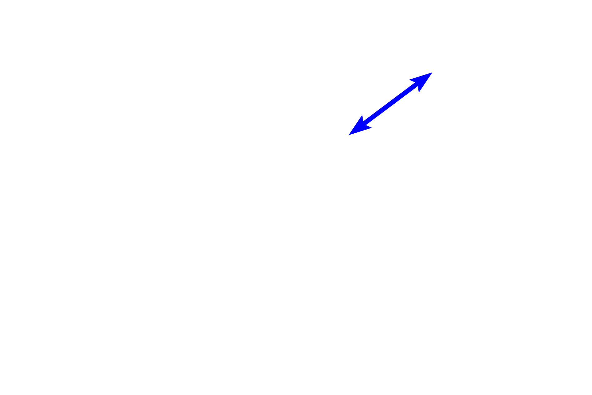 Forming Hassall’s corpuscle <p>Though primarily composed of epithelial reticular cells, other cells types are present. One population of epithelial reticular cells forms Hassall’s corpuscles, also called thymic corpuscles.  Hassall’s corpuscles occur only in the medulla.  Epithelial reticular cells are arranged as concentric flattened cells around a core of keratinzed material that may degenerate or become calcified.  The exact function of Hassall’s corpuscles is unknown.  1000x</p>
