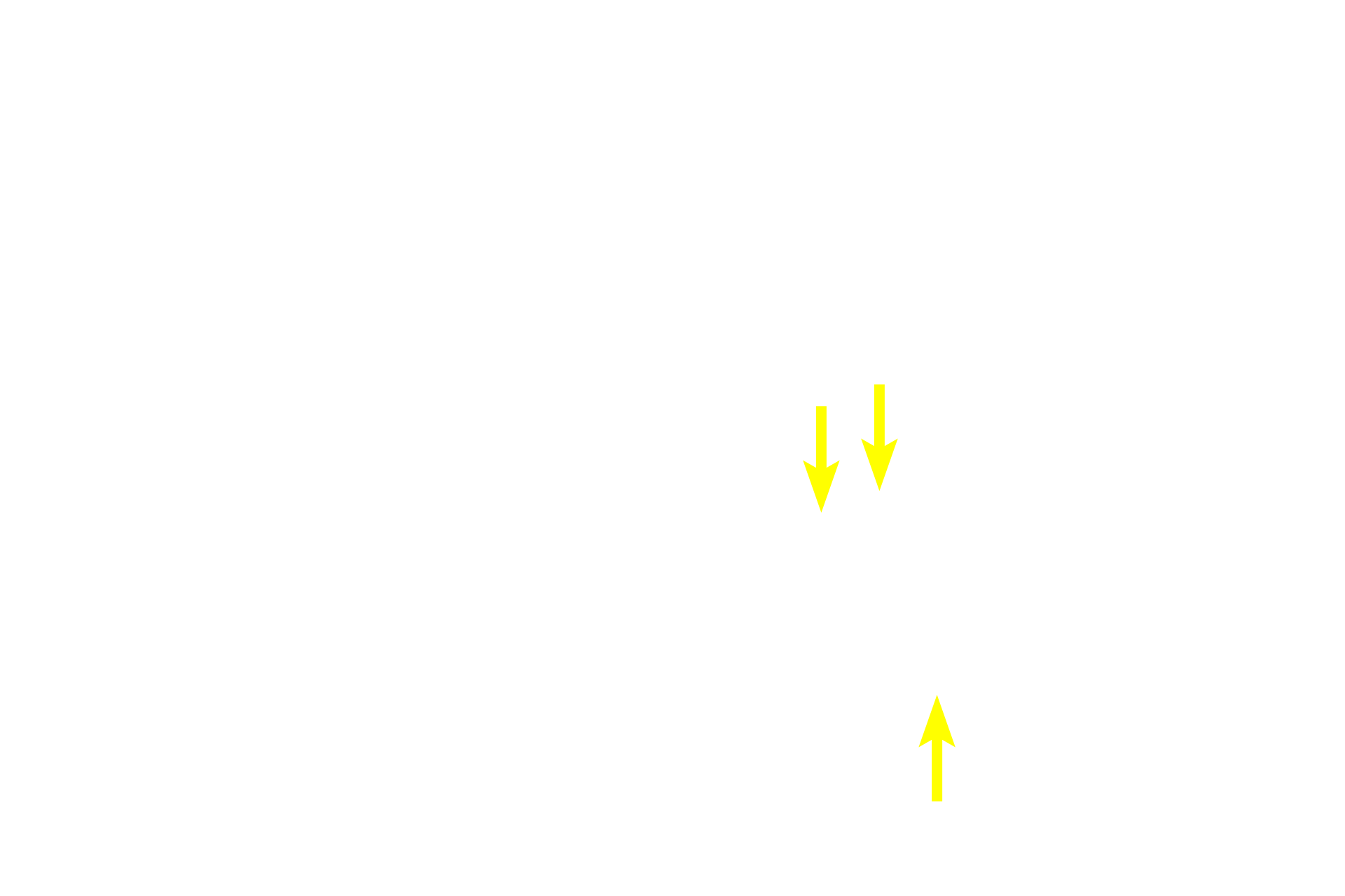 Keratohyalin granules > <p>Within Hassall’s corpuscles, epithelial reticular cells clearly demonstrated basophilic keratohyalin granules and strongly eosinophilic keratin filaments.  There may also be evidence of keratinization similar to that seen in the epidermis of the skin, reflecting the epithelial origin of these cells.</p>
