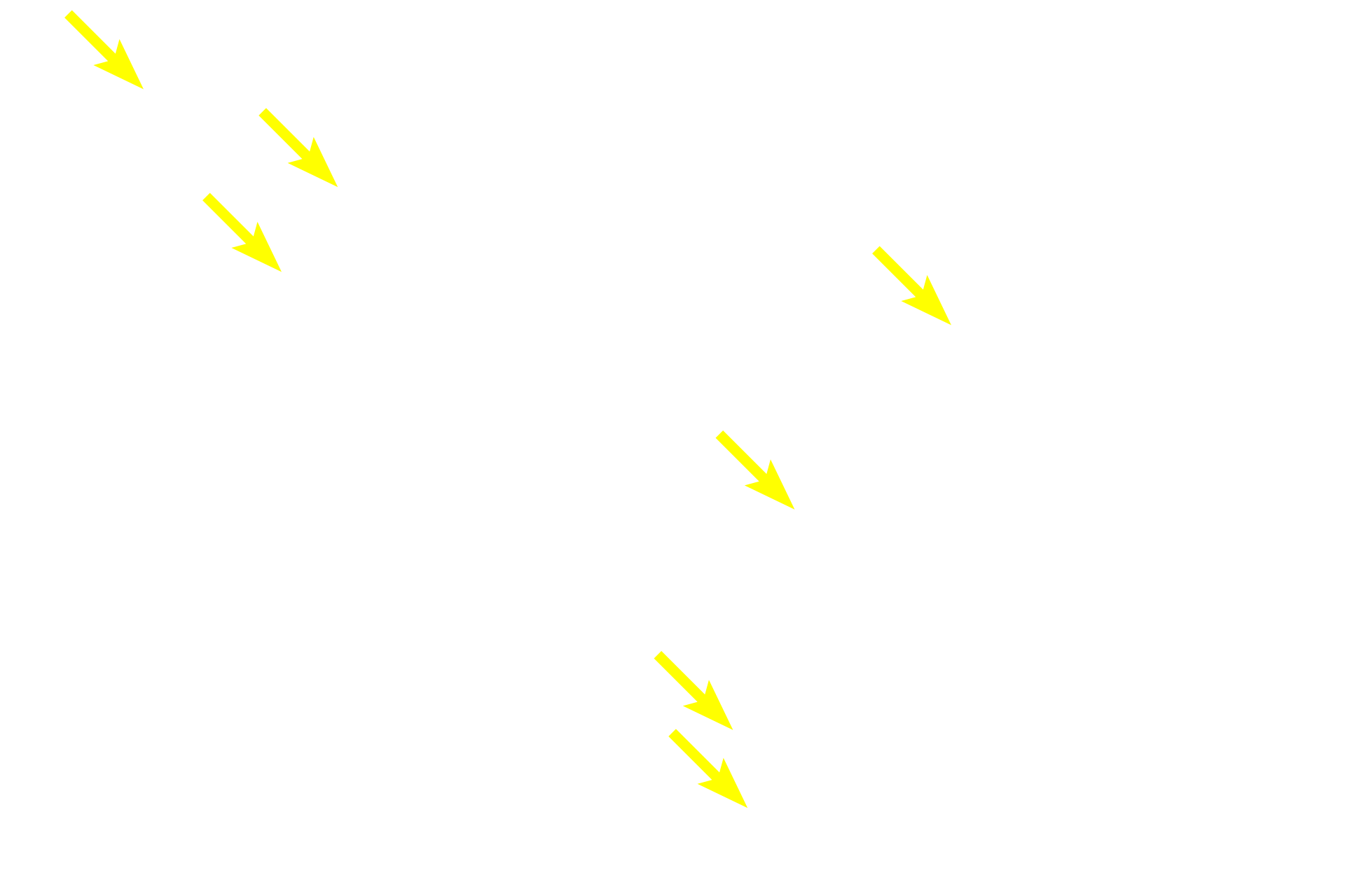 Keratin filaments <p>Within Hassall’s corpuscles, epithelial reticular cells clearly demonstrate basophilic keratohyalin granules and strongly eosinophilic keratin filaments.  There may also be evidence of keratinization similar to that seen in the epidermis of the skin, reflecting the epithelial origin of these cells.</p>
