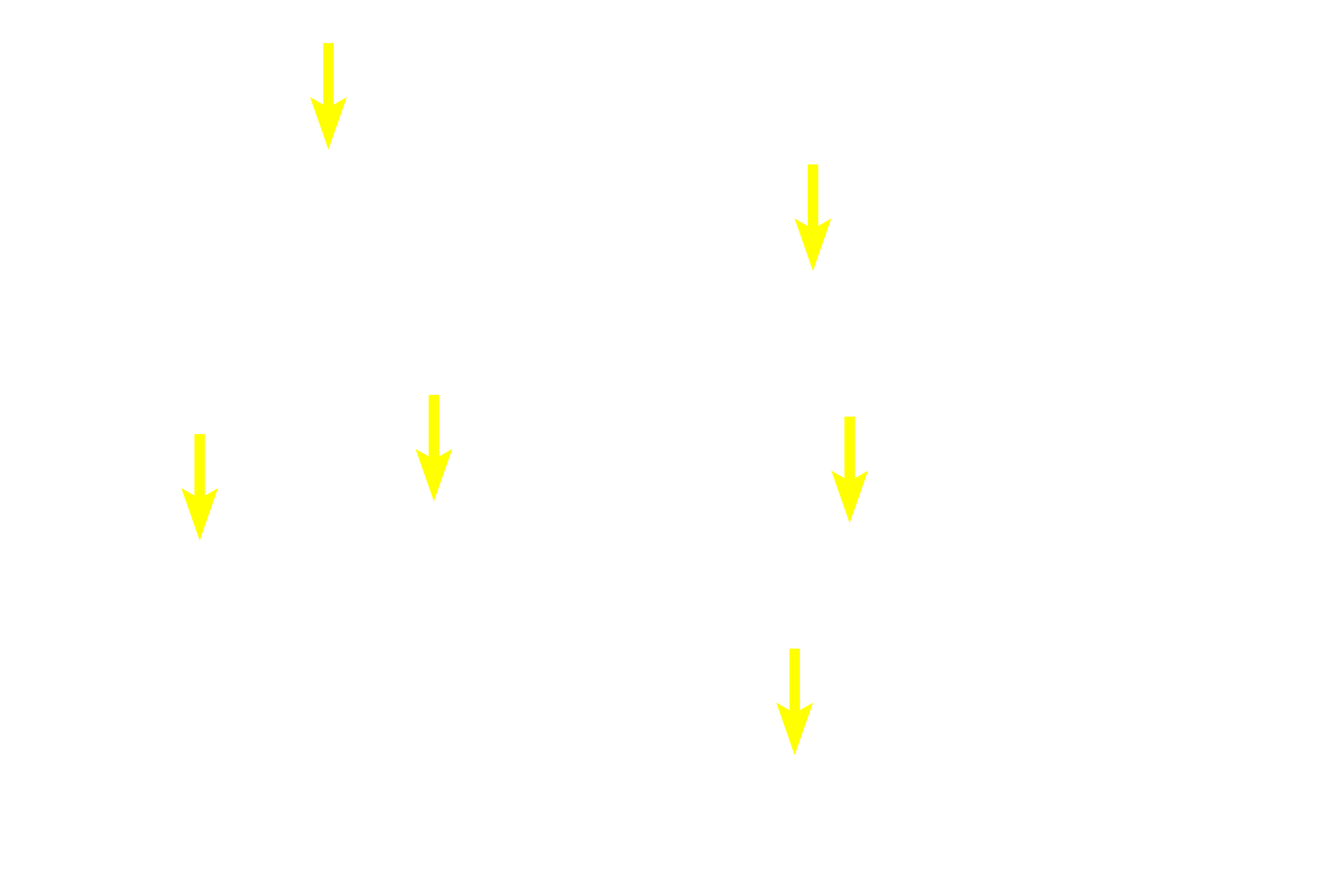 Epithelial reticular cells > <p>Epithelial reticular cells have large, very euchromatic nuclei that closely resemble the nuclei of other epithelial reticular cells in the parenchyma of the medulla and cortex.</p>
