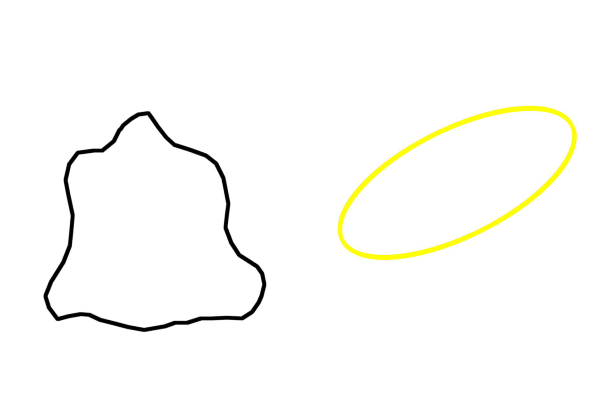 Diffuse lymphoid tissue > <p>Diffuse lymphoid tissue in the lamina propria is present either as isolated patches (shown here) or associated with aggregated lymphoid tissues, such as tonsils and Peyer’s patches. Diffuse lymphoid tissue is also found in the paracortex of the lymph node and the white pulp of the spleen. </p>
