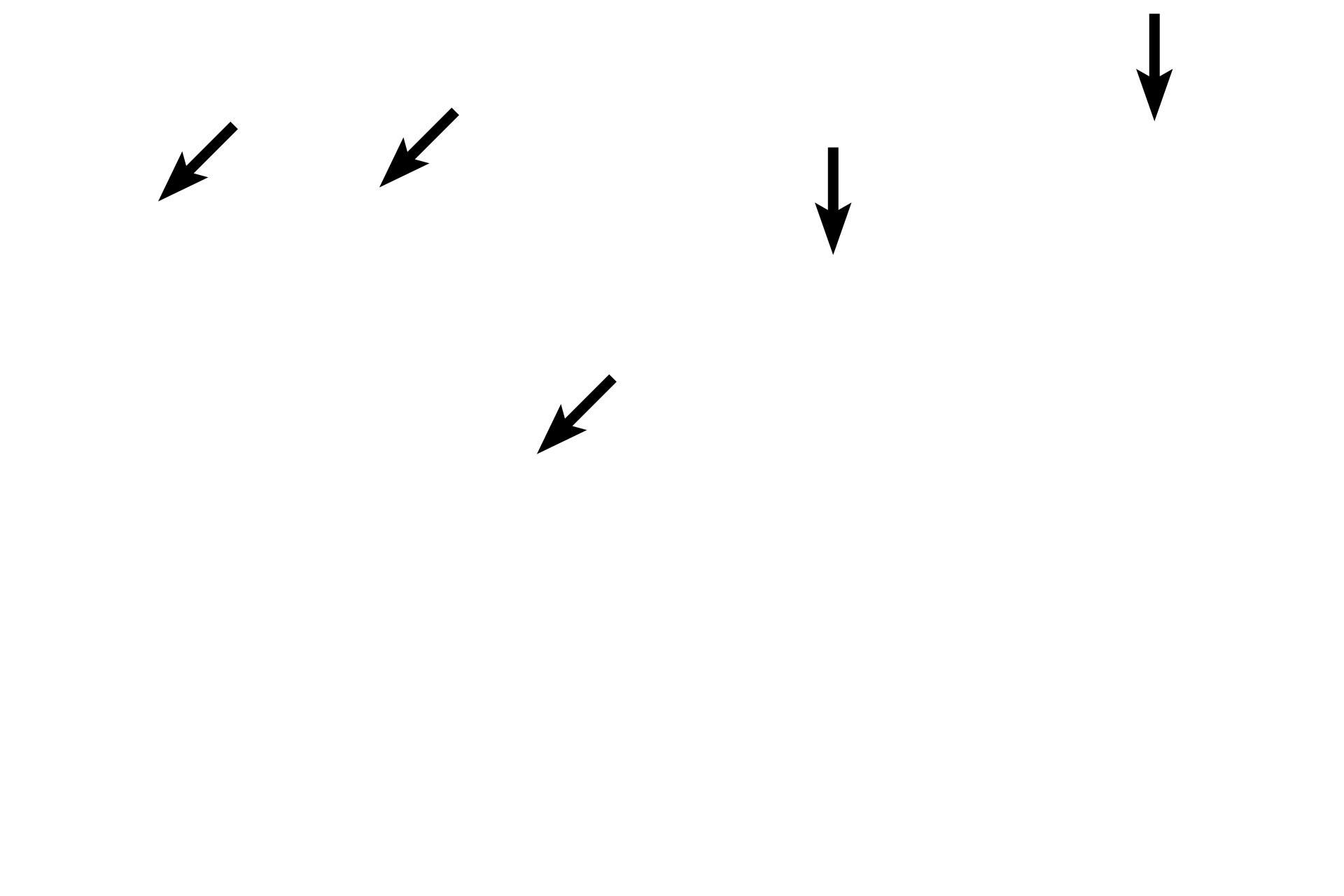 Epithelium > <p>These mucosas are lined by simple columnar epithelium on the left and by stratified squamous moist epithelium on the right.  These epithelia provide a barrier against microbial invasion. If microbes penetrate this epithelium and enter the lamina propria, they may be phagocytosed or may encounter diffuse lymphoid tissue, which produces an immune response.</p>
