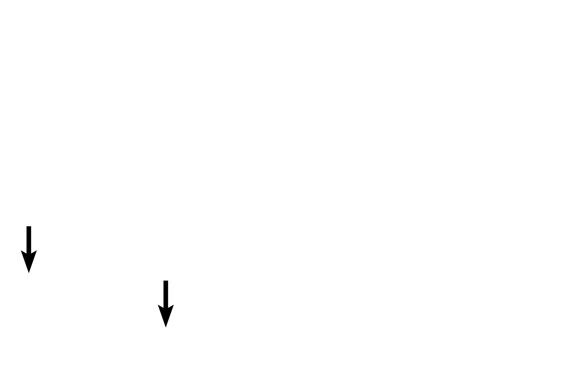 Muscularis mucosae <p>These mucosas are lined by simple columnar epithelium on the left and by stratified squamous moist epithelium on the right.  These epithelia provide a barrier against microbial invasion. If microbes penetrate this epithelium and enter the lamina propria, they may be phagocytosed or may encounter diffuse lymphoid tissue, which produces an immune response.</p>
