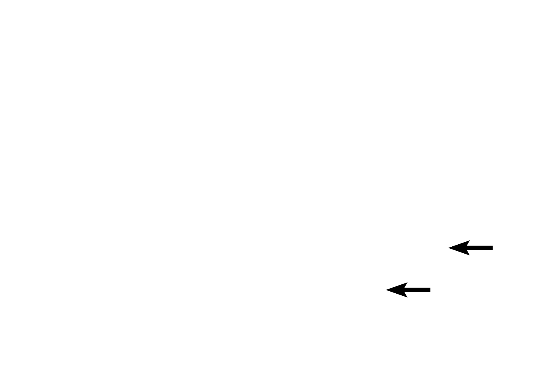 Lymphatic vessel <p>These mucosas are lined by simple columnar epithelium on the left and by stratified squamous moist epithelium on the right.  These epithelia provide a barrier against microbial invasion. If microbes penetrate this epithelium and enter the lamina propria, they may be phagocytosed or may encounter diffuse lymphoid tissue, which produces an immune response.</p>
