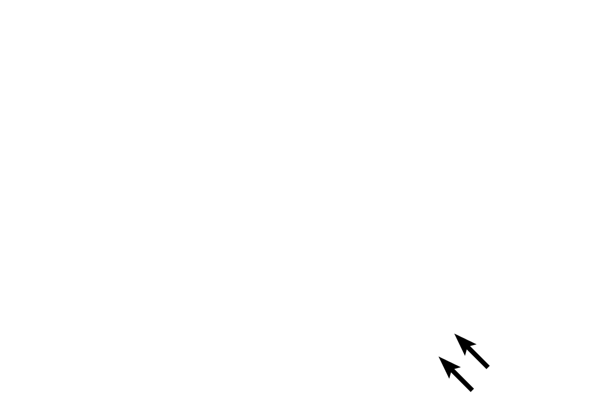 Arteriole and venule <p>These mucosas are lined by simple columnar epithelium on the left and by stratified squamous moist epithelium on the right.  These epithelia provide a barrier against microbial invasion. If microbes penetrate this epithelium and enter the lamina propria, they may be phagocytosed or may encounter diffuse lymphoid tissue, which produces an immune response.</p>
