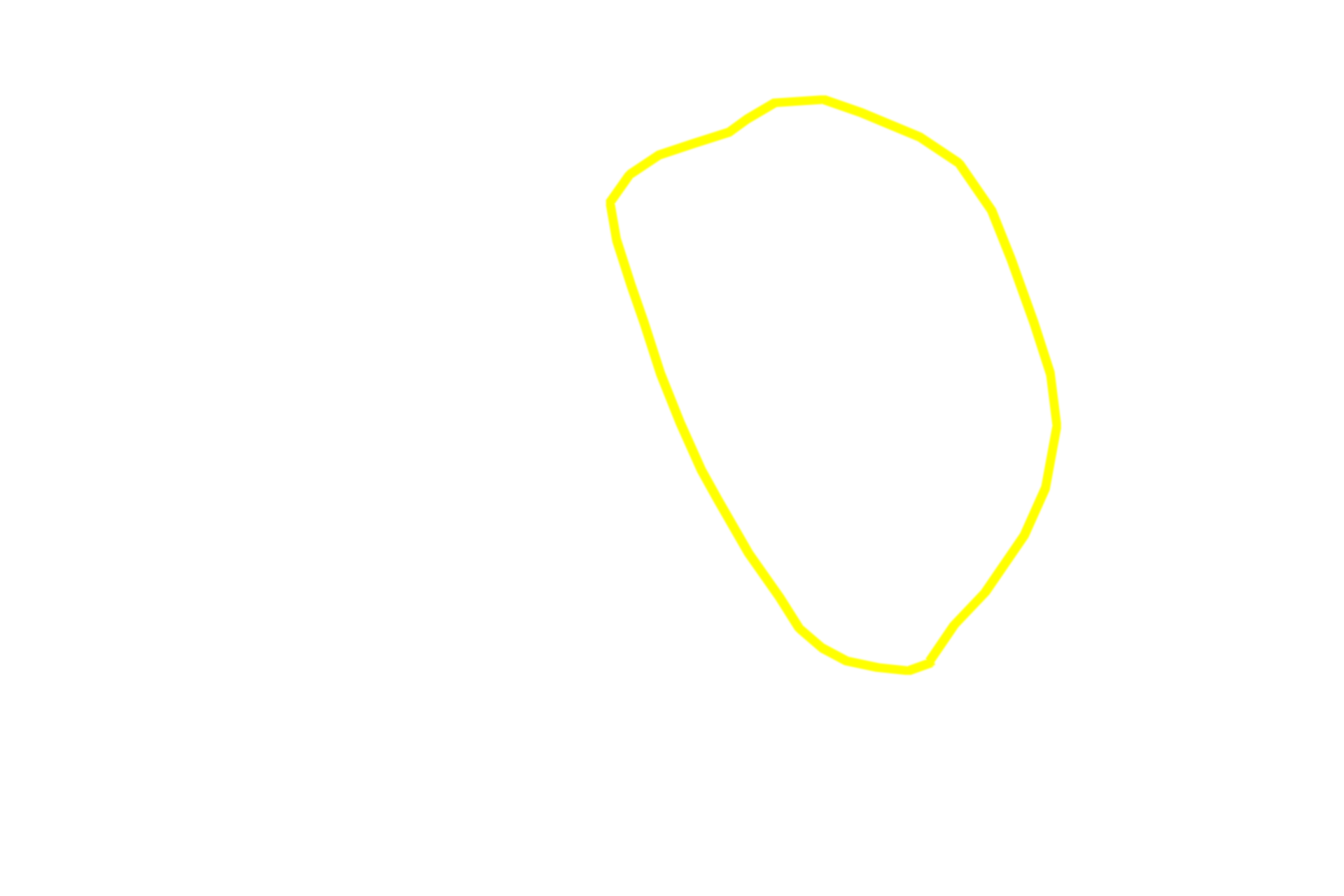  - Germinal center <p>One of the secondary lymphoid nodules from the previous field is shown at higher magnification.  The light and dark regions of the germinal center and the densely packed lymphocytes around its perimeter are visible.  200x</p>
