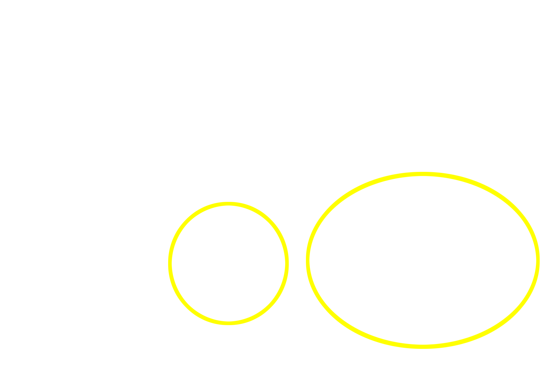 Secondary lymphoid nodules <p>Lymphoid nodules also occur in aggregations, such as Peyer’s patches.  Although located throughout the small intestine, Peyer’s patches are regularly found in the ileum.  A single Peyer’s patch contains clusters of secondary nodules surrounded by diffuse lymphoid tissue.  A dome is typically seen on the luminal side of the patch.  40x</p>
