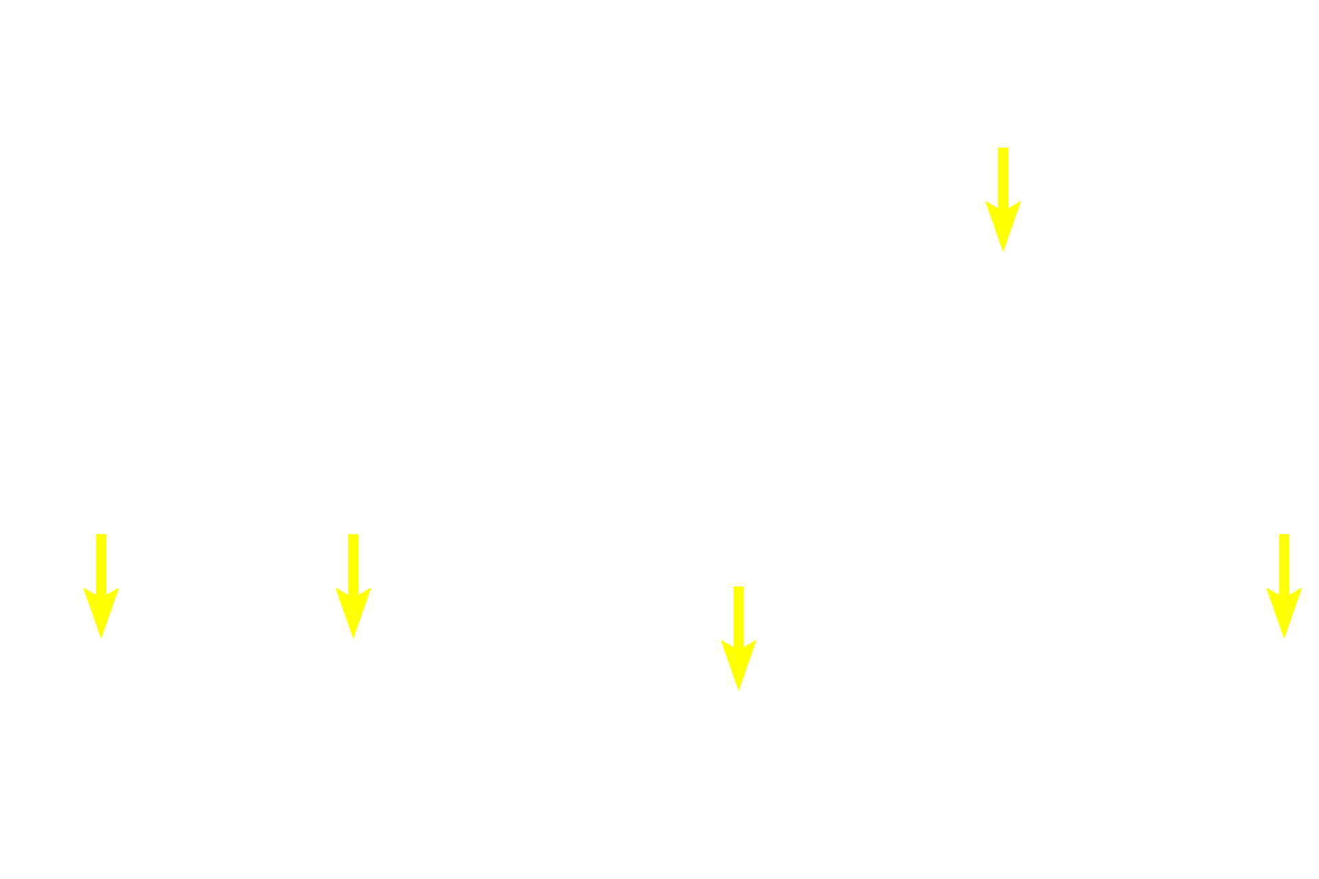 Diffuse lymphoid tissue <p>Lymphoid nodules also occur in aggregations, such as Peyer’s patches.  Although located throughout the small intestine, Peyer’s patches are regularly found in the ileum.  A single Peyer’s patch contains clusters of secondary nodules surrounded by diffuse lymphoid tissue.  A dome is typically seen on the luminal side of the patch.  40x</p>
