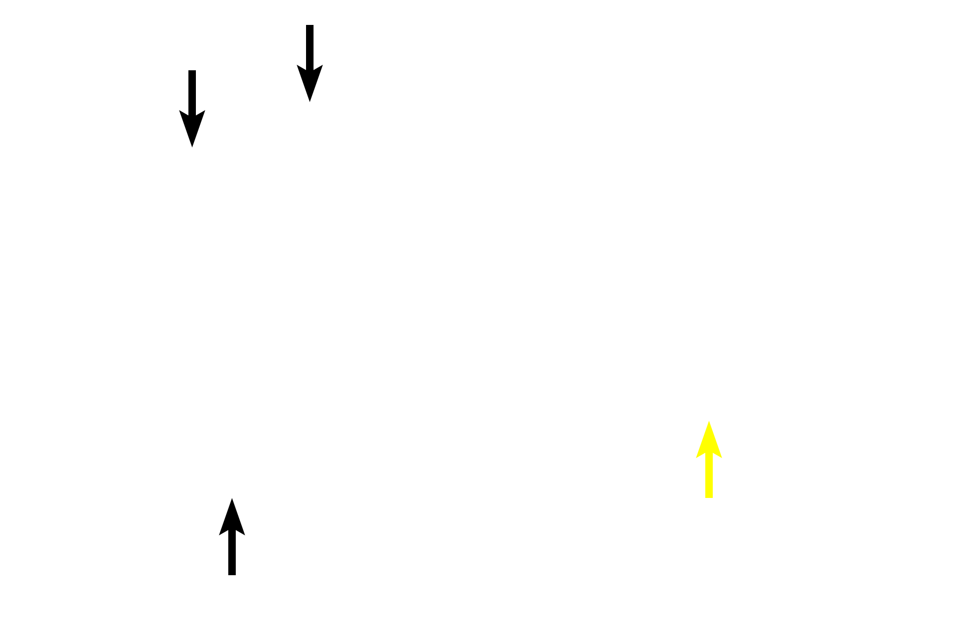 Stratified squamous epithelium <p>Tonsils form a ring of lymphoid tissue in the lamina propria around oral and nasal pharynges.  This palatine tonsil is covered by the stratified squamous epithelium of the oropharynx that invaginates into the tonsil, forming multiple crypts.  A partial capsule of dense connective tissue separates the tonsil from underlying connective tissue.  10x</p>
