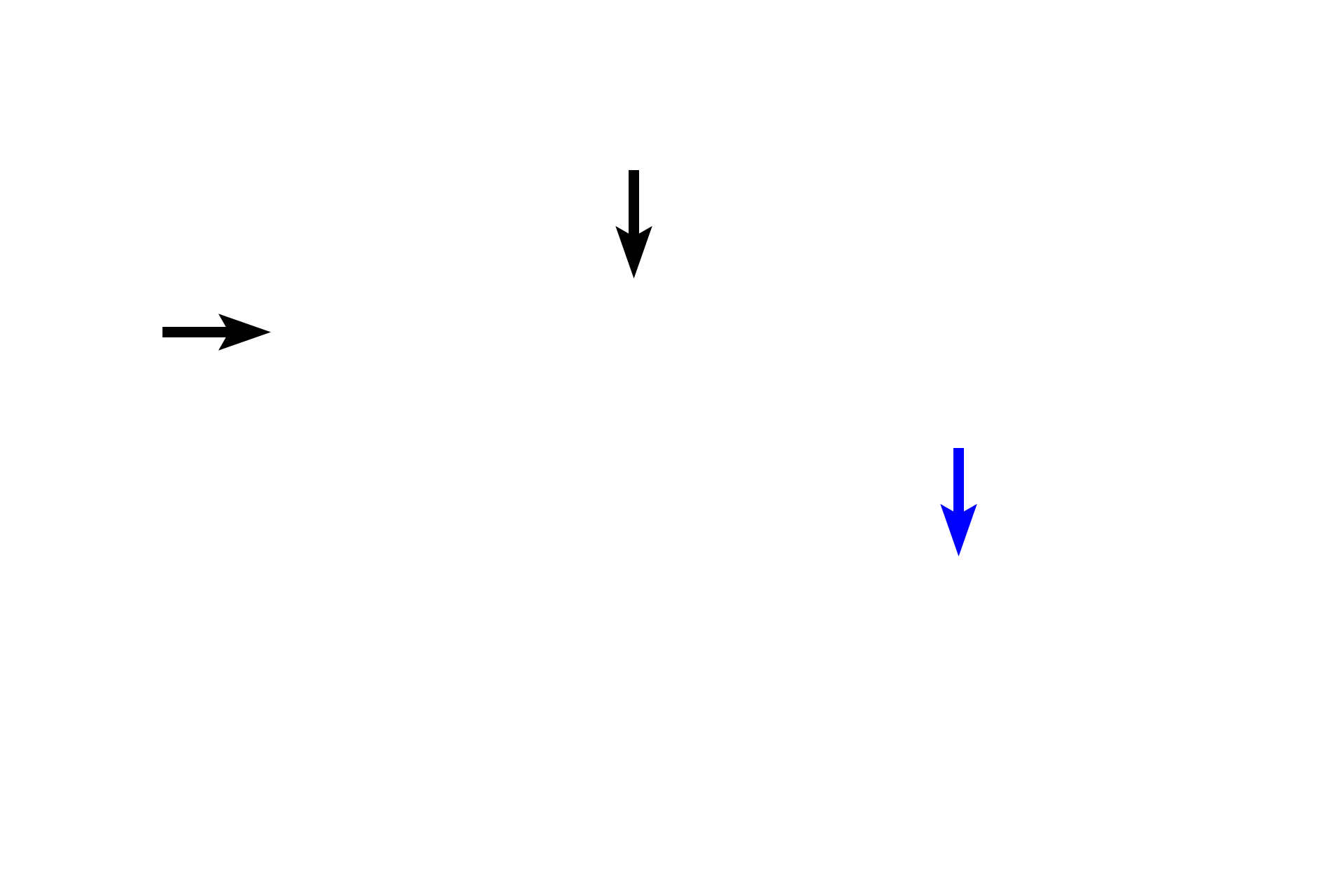 Crypts <p>Tonsils form a ring of lymphoid tissue in the lamina propria around oral and nasal pharynges.  This palatine tonsil is covered by the stratified squamous epithelium of the oropharynx that invaginates into the tonsil, forming multiple crypts.  A partial capsule of dense connective tissue separates the tonsil from underlying connective tissue.  10x</p>
