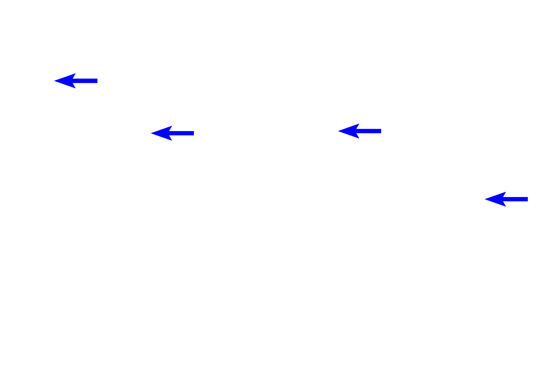  - Lymphocytes <p>The pharyngeal tonsils are lined by respiratory epithelium, pseudostratified ciliated columnar. This epithelium is highly infiltrated with lymphocytes and other white blood cells, presenting a greatly altered appearance from the usual pharyngeal epithelium. Note the diffuse lymphoid tissue in the underlying lamina propria. 1000x</p>
