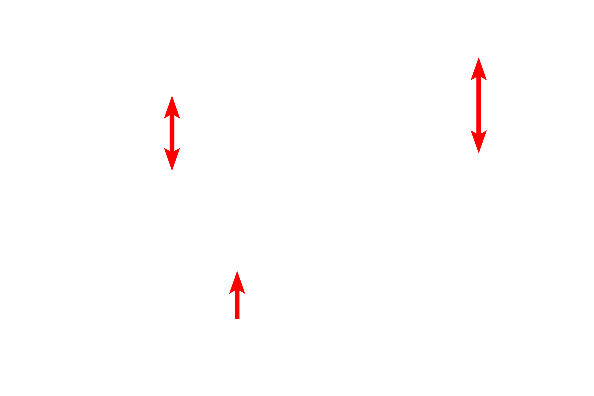 High endothelial venules <p>High endothelial venules (HEVs) are modified, postcapillary venules lined by a simple cuboidal, rather than the simple squamous epithelium lining other venules. This modification allows lymphocytes to leave the blood through the HEVs and enter the lymphoid tissue. HEVs are located in the appendix, Peyer’s patch, tonsil (seen here) and lymph node.  600x</p>
