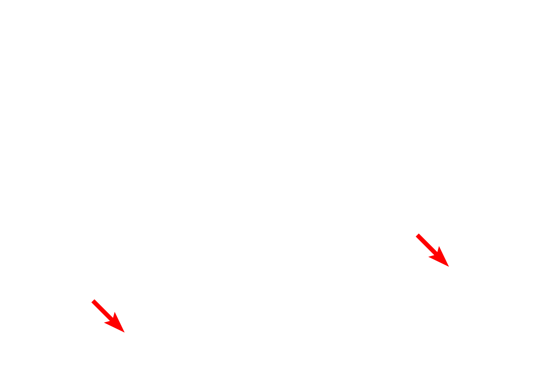 Venules <p>High endothelial venules (HEVs) are modified, postcapillary venules lined by a simple cuboidal, rather than the simple squamous epithelium lining other venules. This modification allows lymphocytes to leave the blood through the HEVs and enter the lymphoid tissue. HEVs are located in the appendix, Peyer’s patch, tonsil (seen here) and lymph node.  600x</p>
