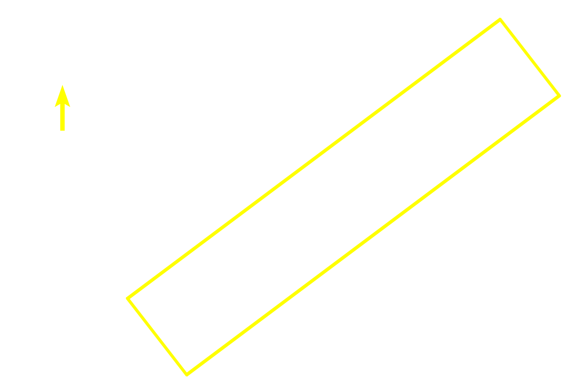 High endothelial venules <p>High endothelial venules are surrounded by diffuse lymphoid tissue in this section of lymph node.  The cuboidal epithelium lining these venules distinguishes them from normal postcapillary venules.  The venule to the right is cut in longitudinal section.  400x</p>
