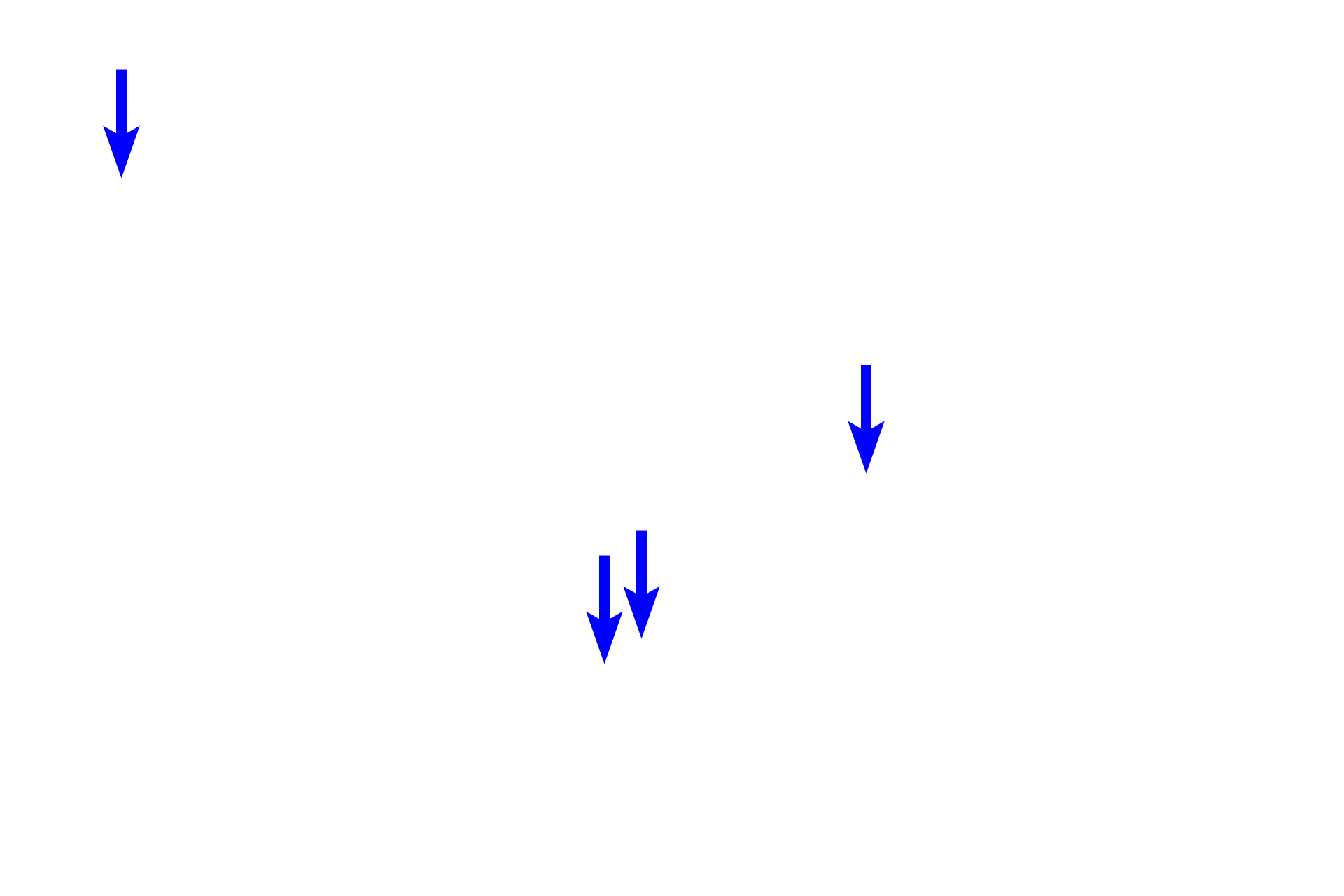 Cuboidal endothelial cells <p>High endothelial venules are surrounded by diffuse lymphoid tissue in this section of lymph node.  The cuboidal epithelium lining these venules distinguishes them from normal postcapillary venules.  The venule to the right is cut in longitudinal section.  400x</p>
