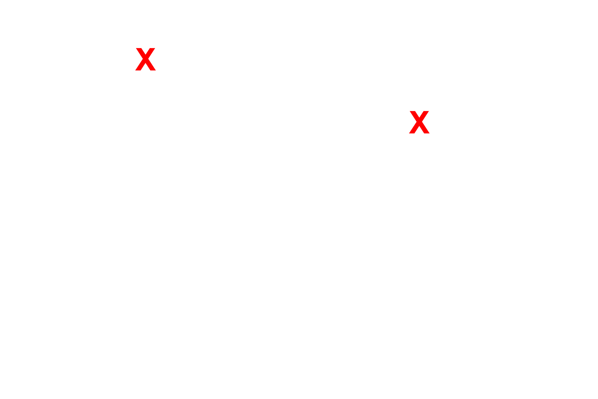 Lymph <p>A portion of the paired valve flaps and the wall of the lymph vessel are seen at higher magnification.  1000x</p>
