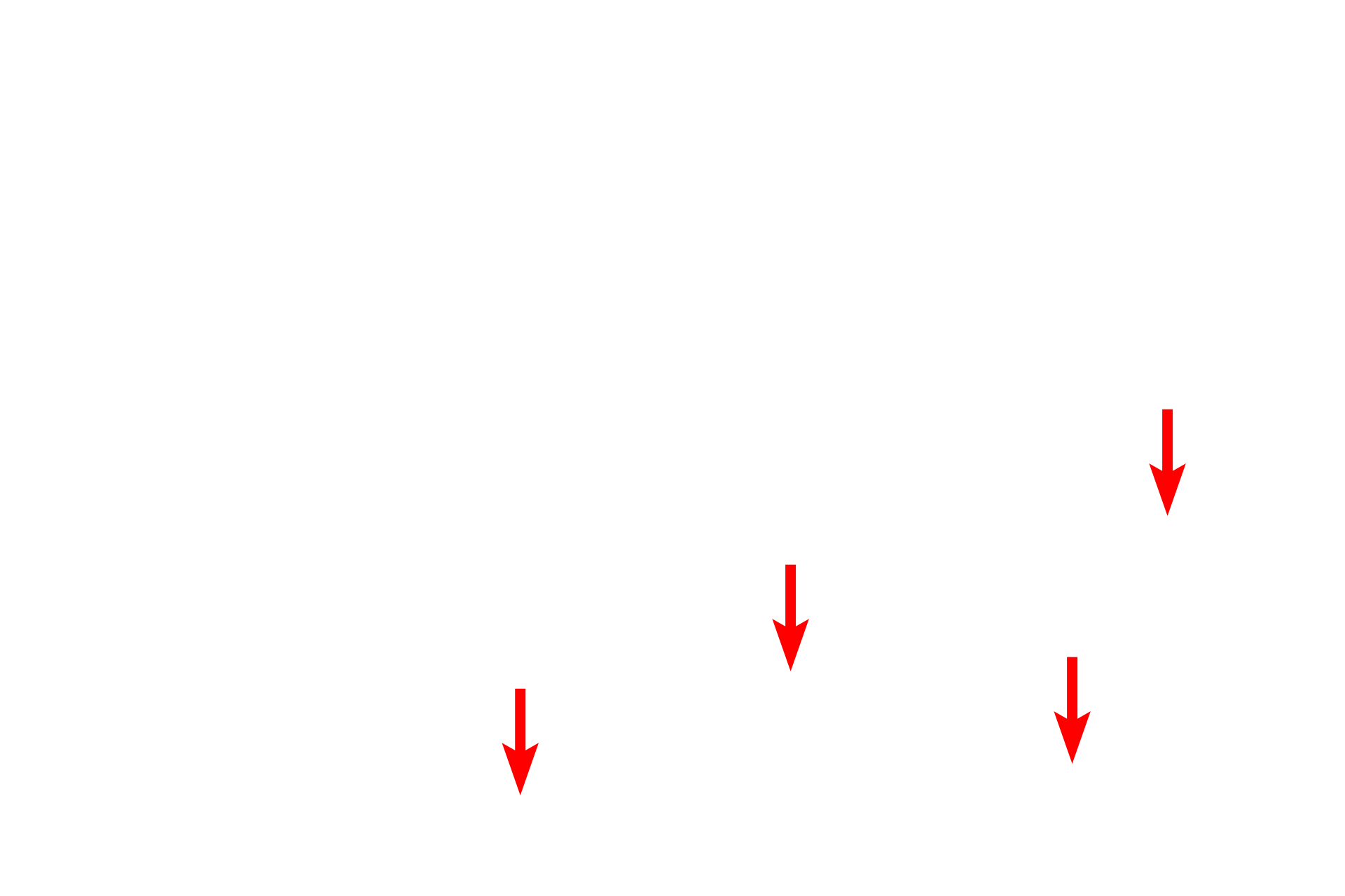 Smooth muscle <p>A portion of the paired valve flaps and the wall of the lymph vessel are seen at higher magnification.  1000x</p>
