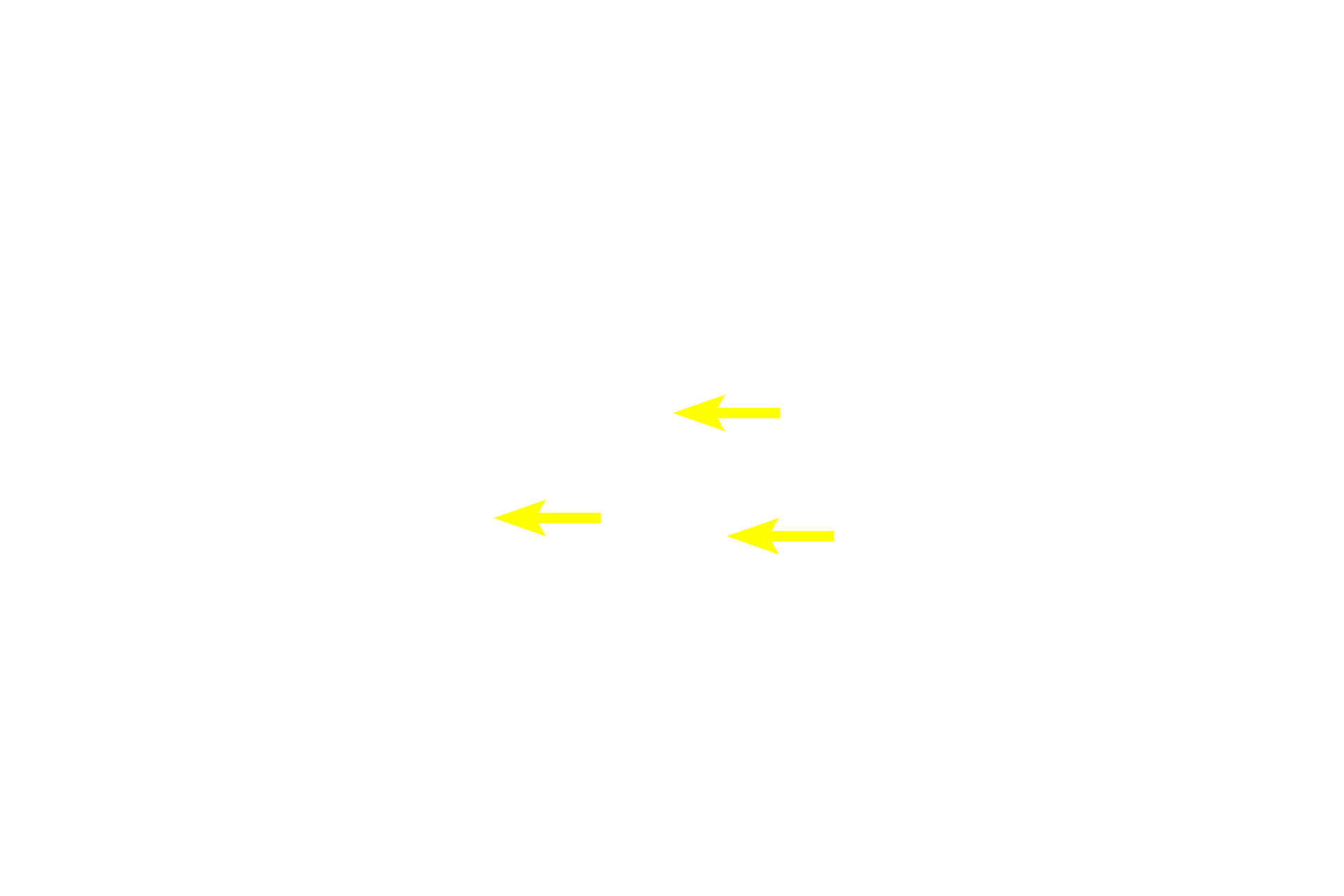 Diffuse lymphatic tissue <p>Secondary nodules consist of an outer mantle (corona) of B lymphocytes surrounding the germinal center, where the immunoresponsive B lymphocytes are formed.  The germinal center forms following antigen stimulation.  The germinal center contains phagocytic cells and large, immature lymphoblasts that divide to form the smaller B lymphocytes.  These B cells migrate to and accumulate at the periphery in the mantle or corona region.</p>
