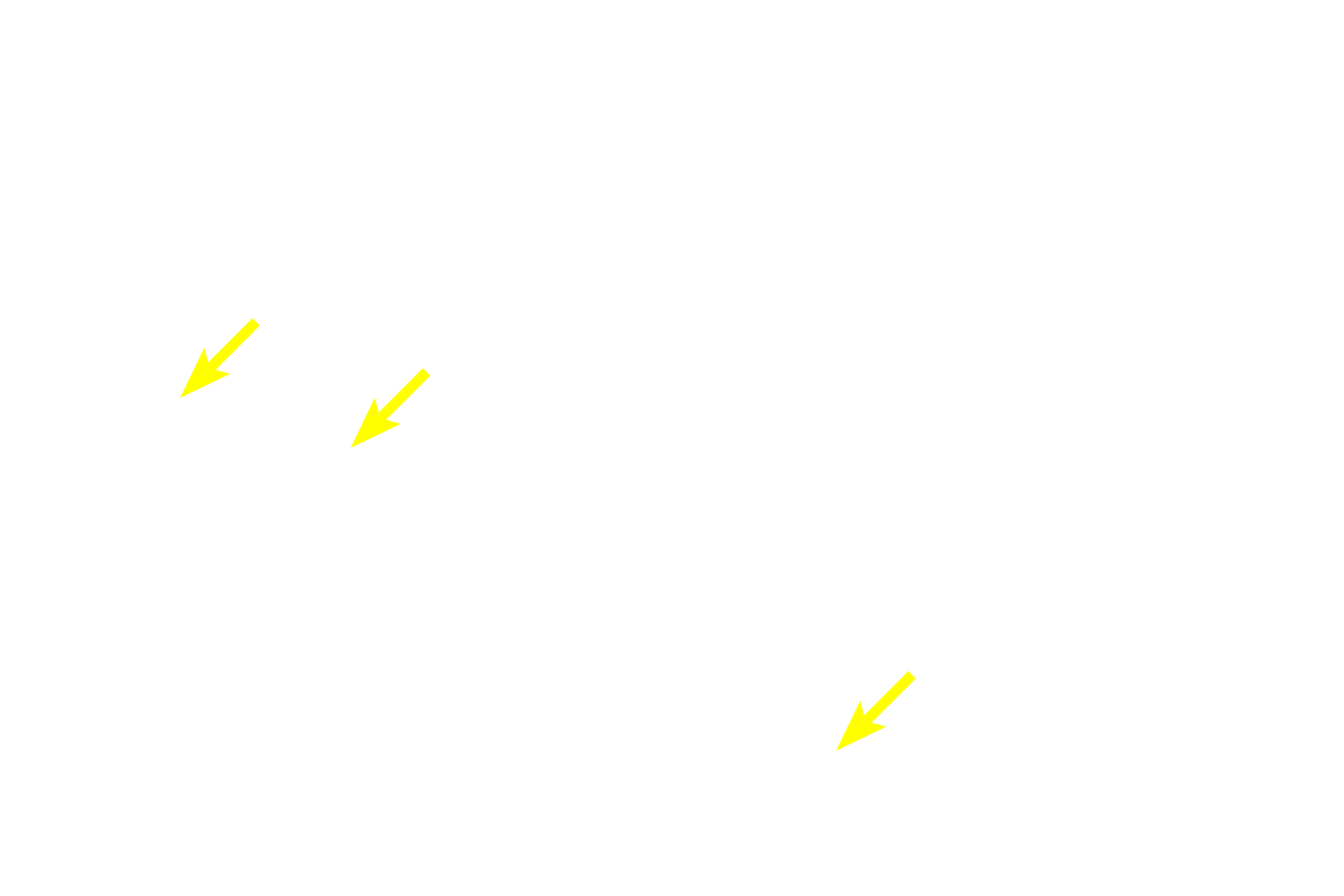 Muscularis mucosae <p>Secondary nodules consist of an outer mantle (corona) of B lymphocytes surrounding the germinal center, where the immunoresponsive B lymphocytes are formed.  The germinal center forms following antigen stimulation.  The germinal center contains phagocytic cells and large, immature lymphoblasts that divide to form the smaller B lymphocytes.  These B cells migrate to and accumulate at the periphery in the mantle or corona region.</p>

