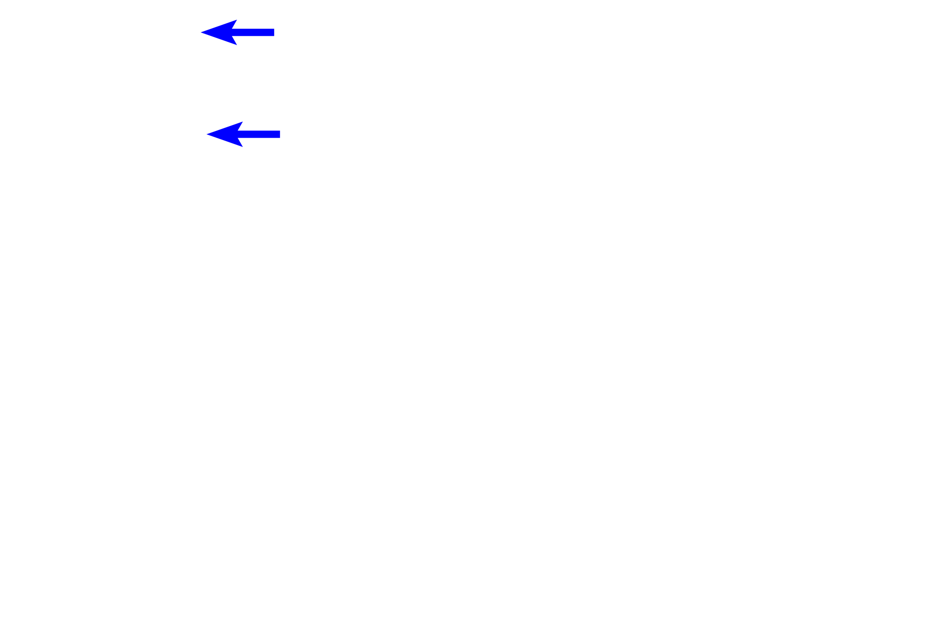 Intestinal lumen <p>This secondary lymphoid nodule is located in the lamina propria of the small intestine.  It has a pale-staining germinal center where lymphoblasts divide to form lymphocytes.  Mature B lymphocytes accumulate at the periphery of the nodule, forming the dark mantle of the nodule.  Nodules in the lamina propria filter tissue fluid.  200x</p>

