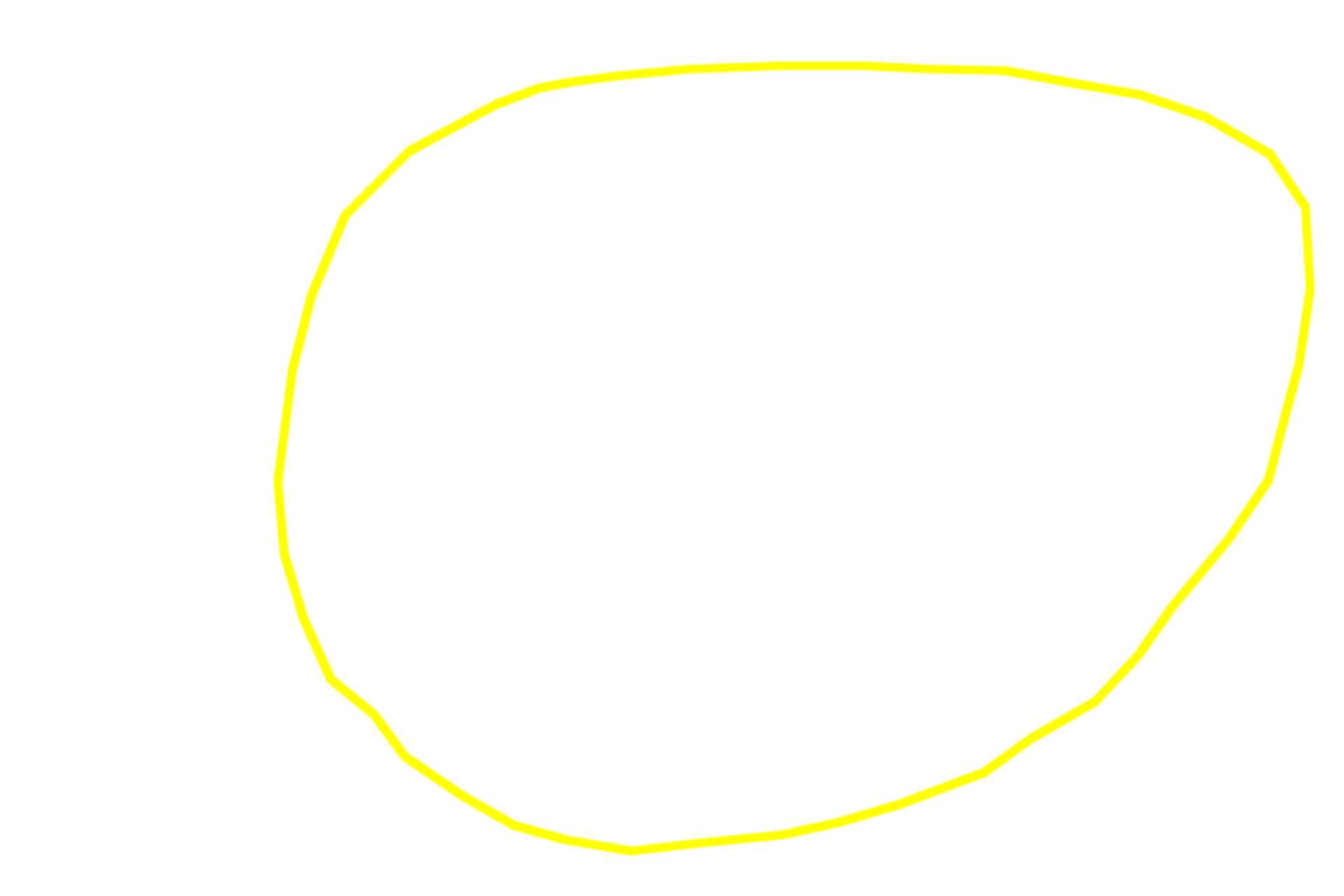 Secondary lymphoid nodule <p>Secondary lymphoid nodules consist of germinal centers surrounded by a perimeter, or mantle, of tightly packed B lymphocytes.  The euchromatic nuclei and abundant cytoplasm of the large, immature lymphoblasts located in the germinal center contribute to the pale appearance of this region.  This nodule is located in the lamina propria of the small intestine.  200x</p>
