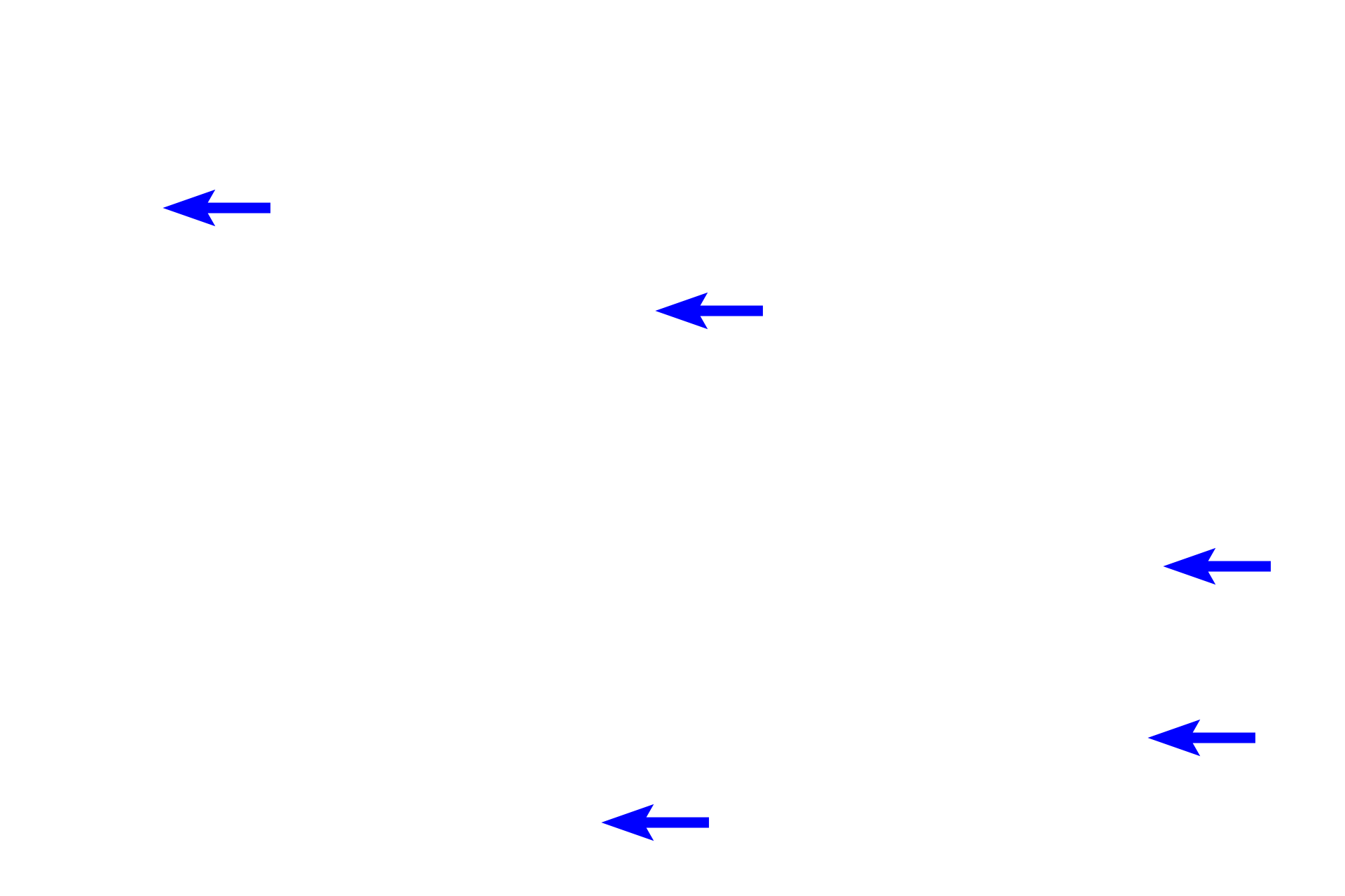  - Immunoblasts <p>The germinal center contains immunoblasts, cells with large, euchromatic nuclei and abundant cytoplasm.  These cells divide, eventually giving rise to small, B lymphocytes that accumulate at the periphery; mitotic figures reflect this activity.  Antigen-presenting cells and macrophages with engulfed, phagocytosed particles are also present in the germinal center.</p>
