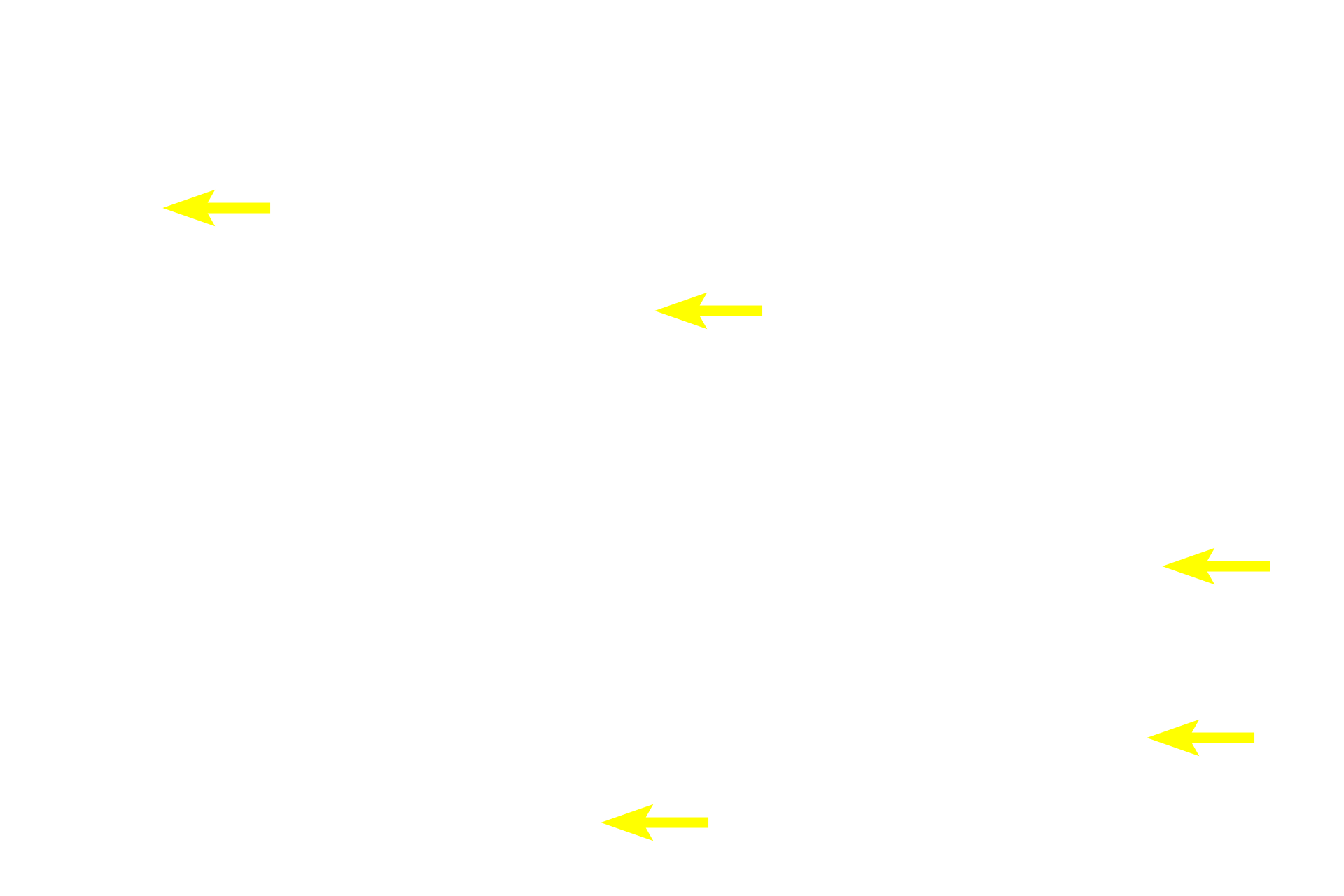  - Immunoblasts <p>After antigenic stimulation, large immunoblasts in the germinal center divide to form B lymphocytes that accumulate in the peripheral mantle.  Mitotic figures indicate this activity.  Reticular connective tissue and the reticular cells that produce them form the stroma of the nodule.  Macrophages and antigen-presenting cells are also present in the germinal center.  1000x</p>
